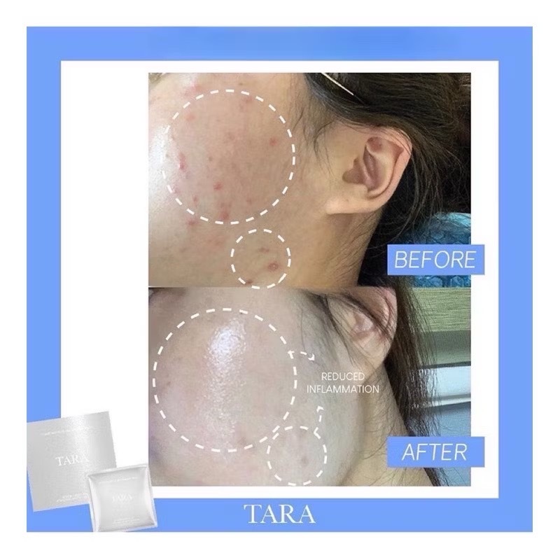 <快速出貨> 🇰🇷 TARA 貴婦品牌 海藻安瓶 水光針面膜 一盒5入