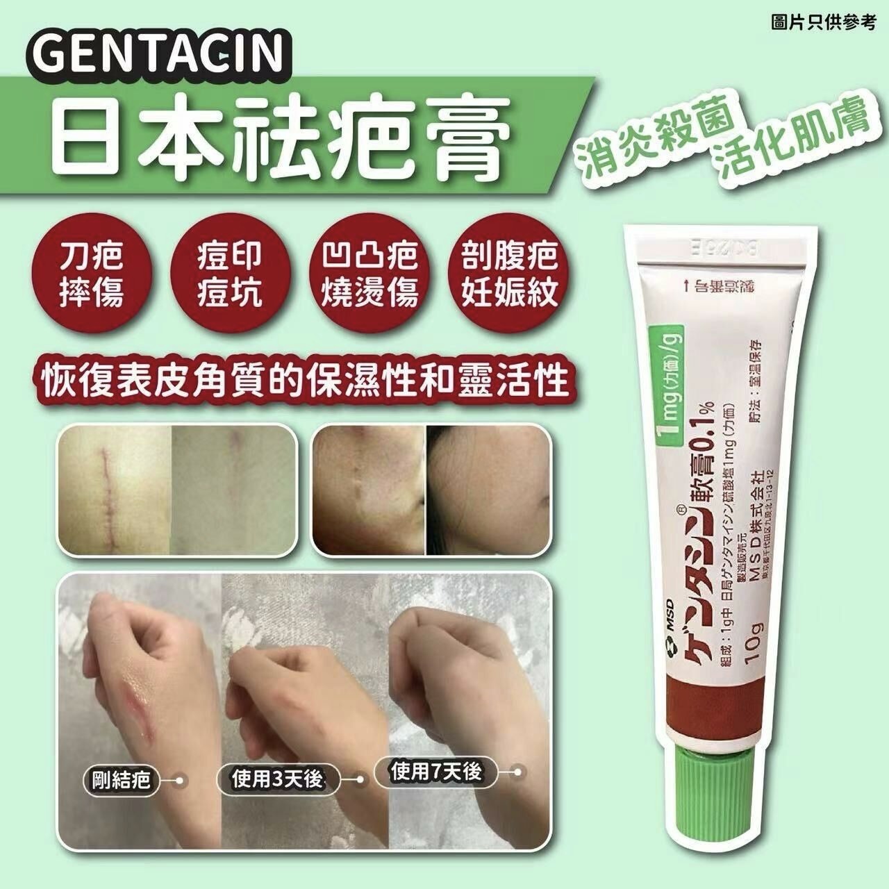 日本MSD祛疤膏(10g)