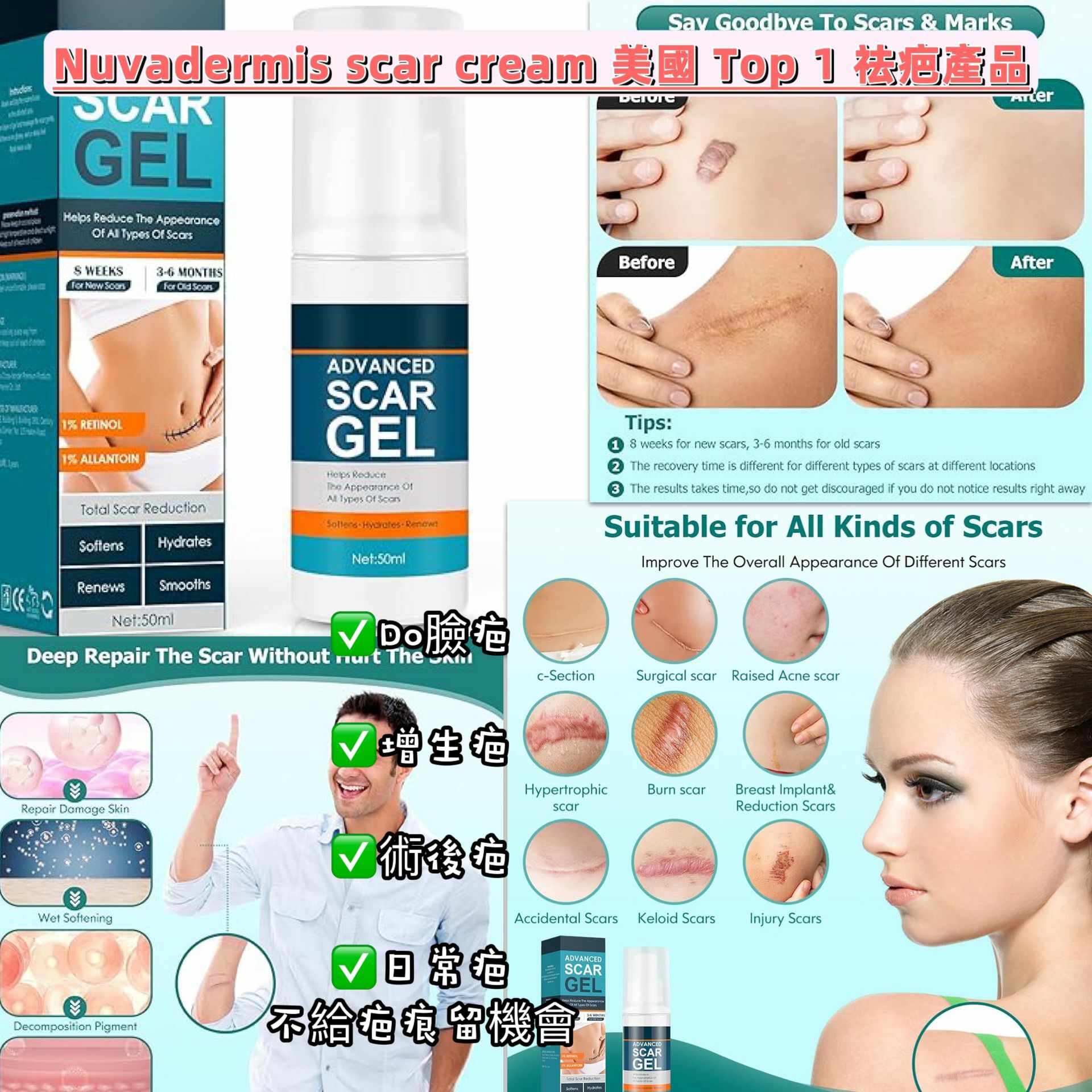 【預購】Scar Gel G102910 祛疤膏