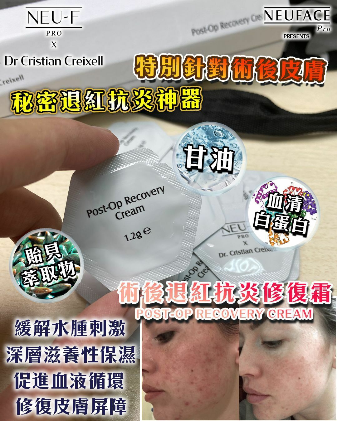NEU-F Pro x Dr. Cristian Creixell Post-Op Recovery Cream