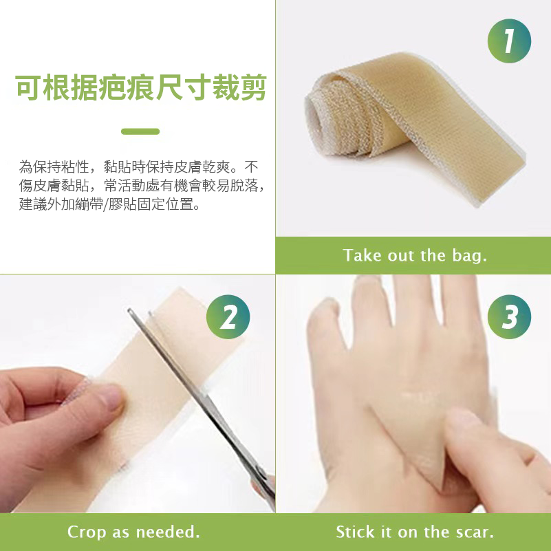 全城熱賣 - 矽凝膠傷疤痕捲貼150CM 防水淡化妊娠紋 修護貼 疤痕贴 自由裁剪 燙傷疤痕 香港特賣