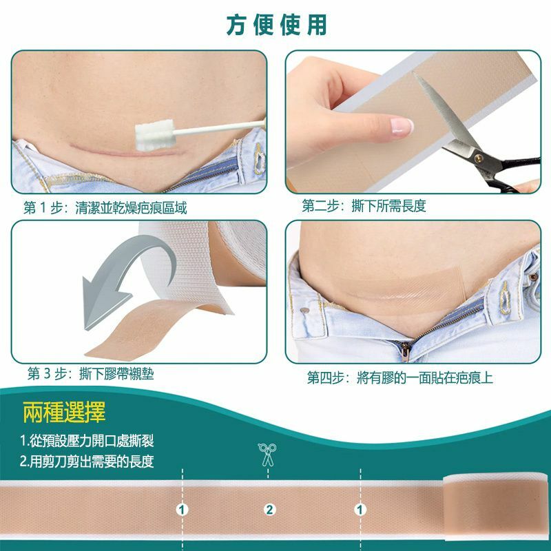 BUBY - 矽膠去疤片  (150x4 cm) 防水疤痕貼 新傷舊傷妊娠紋 傷疤貼 淡化疤痕