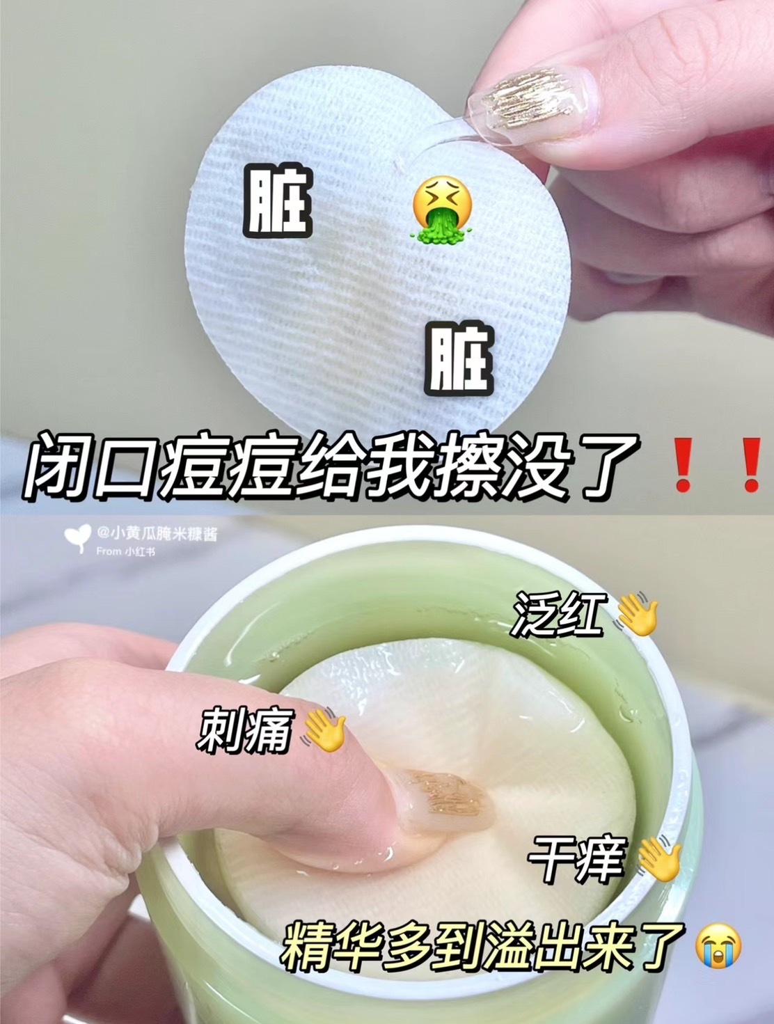 📦預購 🇰🇷Abib-魚腥草舒緩爽膚棉片80片