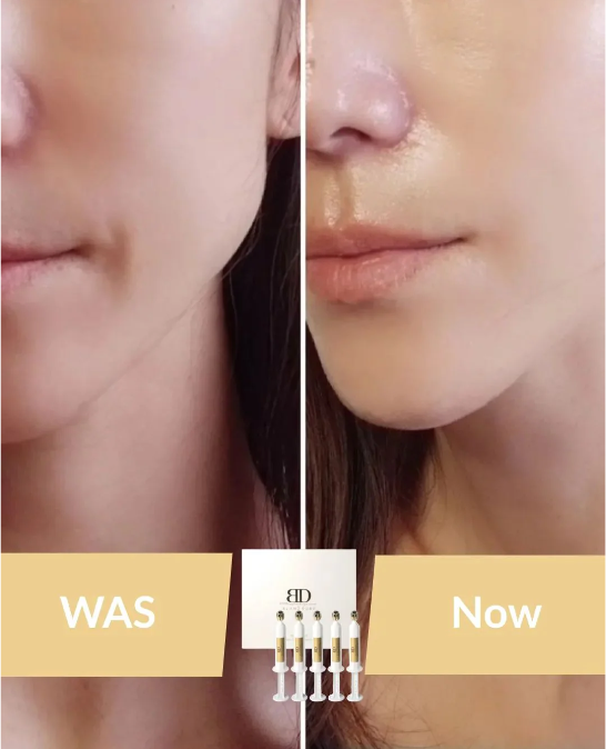 UF06 Nuboncell Blanc 第3代牛奶蛋白針管安瓶精華 7MLX5EA (EXP: 2027 / 01/7)$489