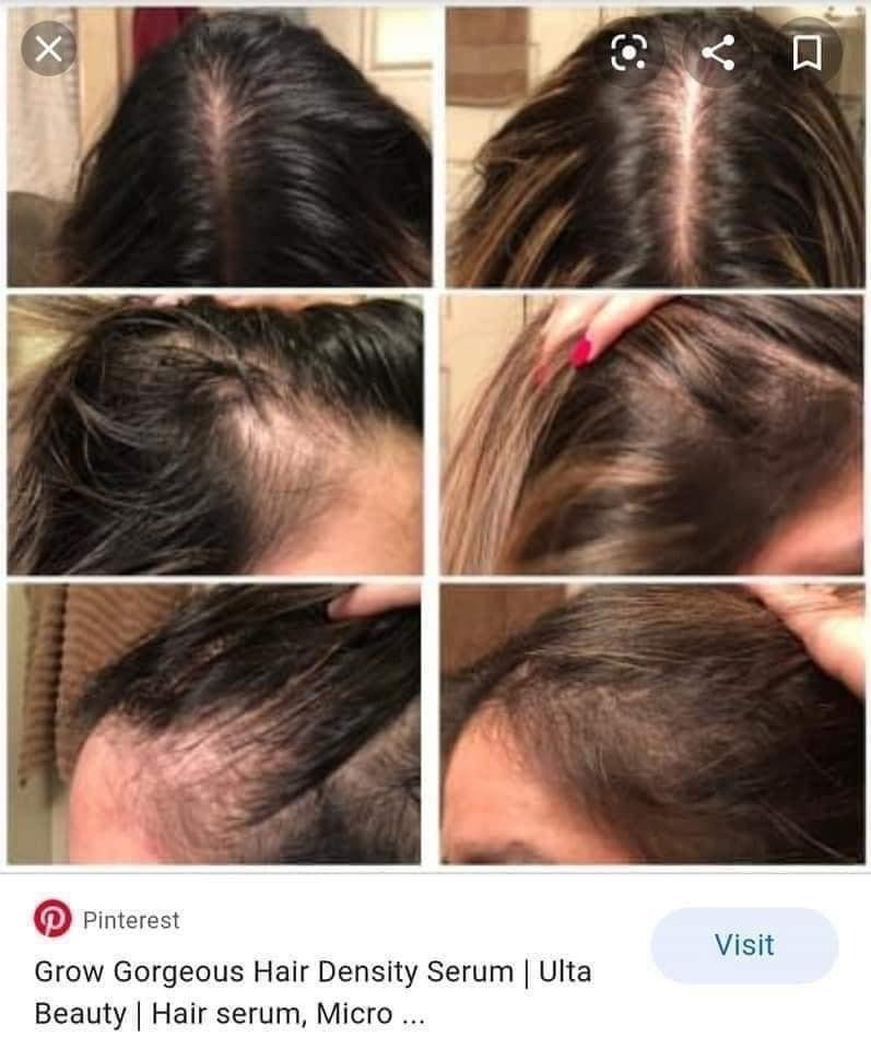 【直播】GROW GORGEOUS L111204 咖啡因生髮系列套裝 (洗髮水+護髮素 740ml)