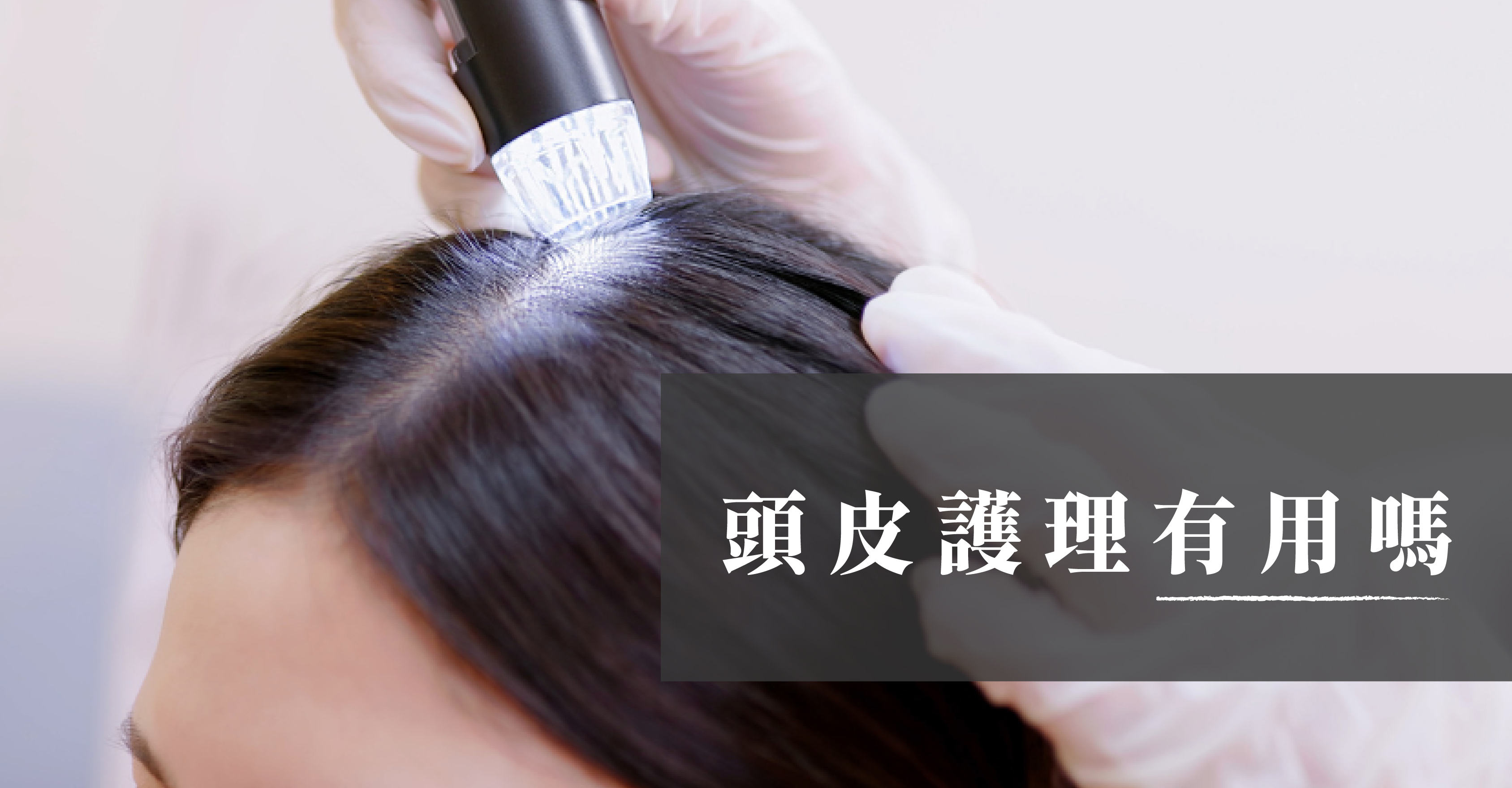 頭皮護理有用嗎