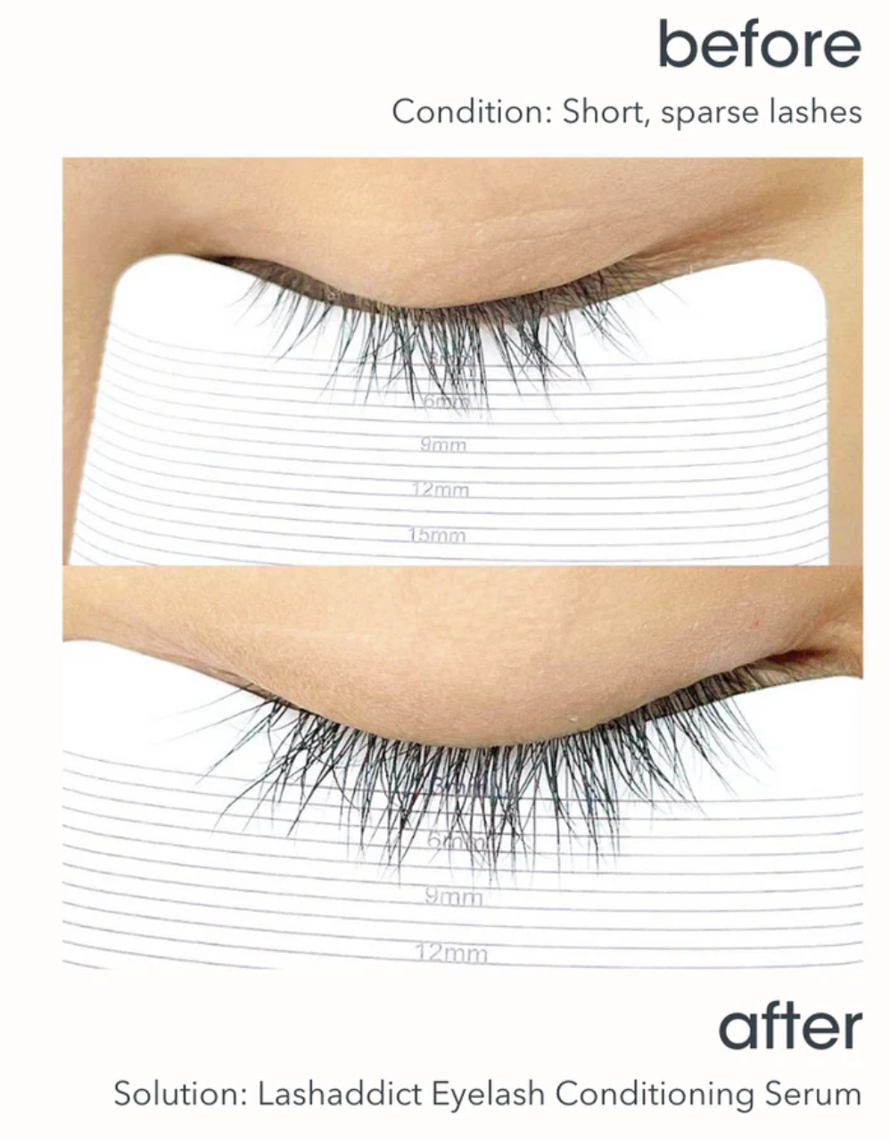 【新品未使用】Lashaddict Eyelash 5ml SOADDICTED Lashaddict Eyelash Conditioning Serum0.18 oz 5 ml