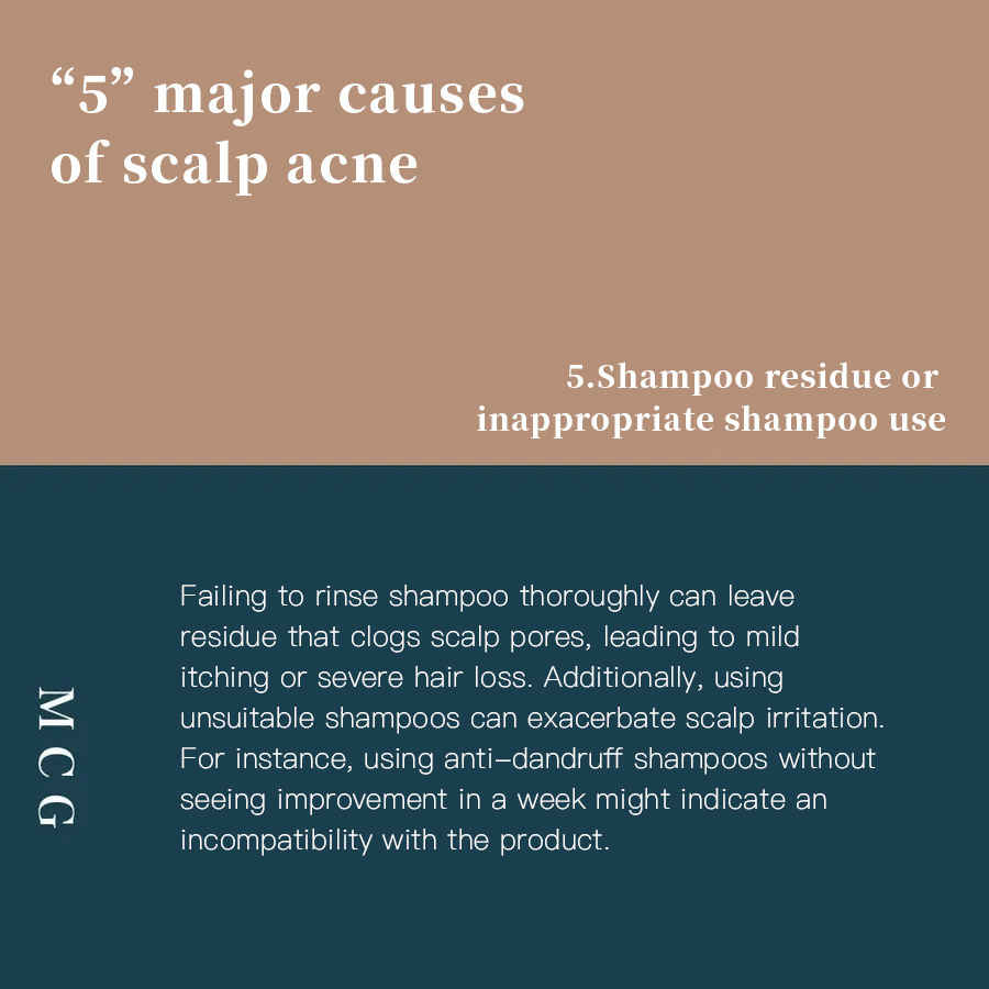 Seasonal Scalp Itch Causes - Shampoo Residue or Use of Unsuitable Shampoo