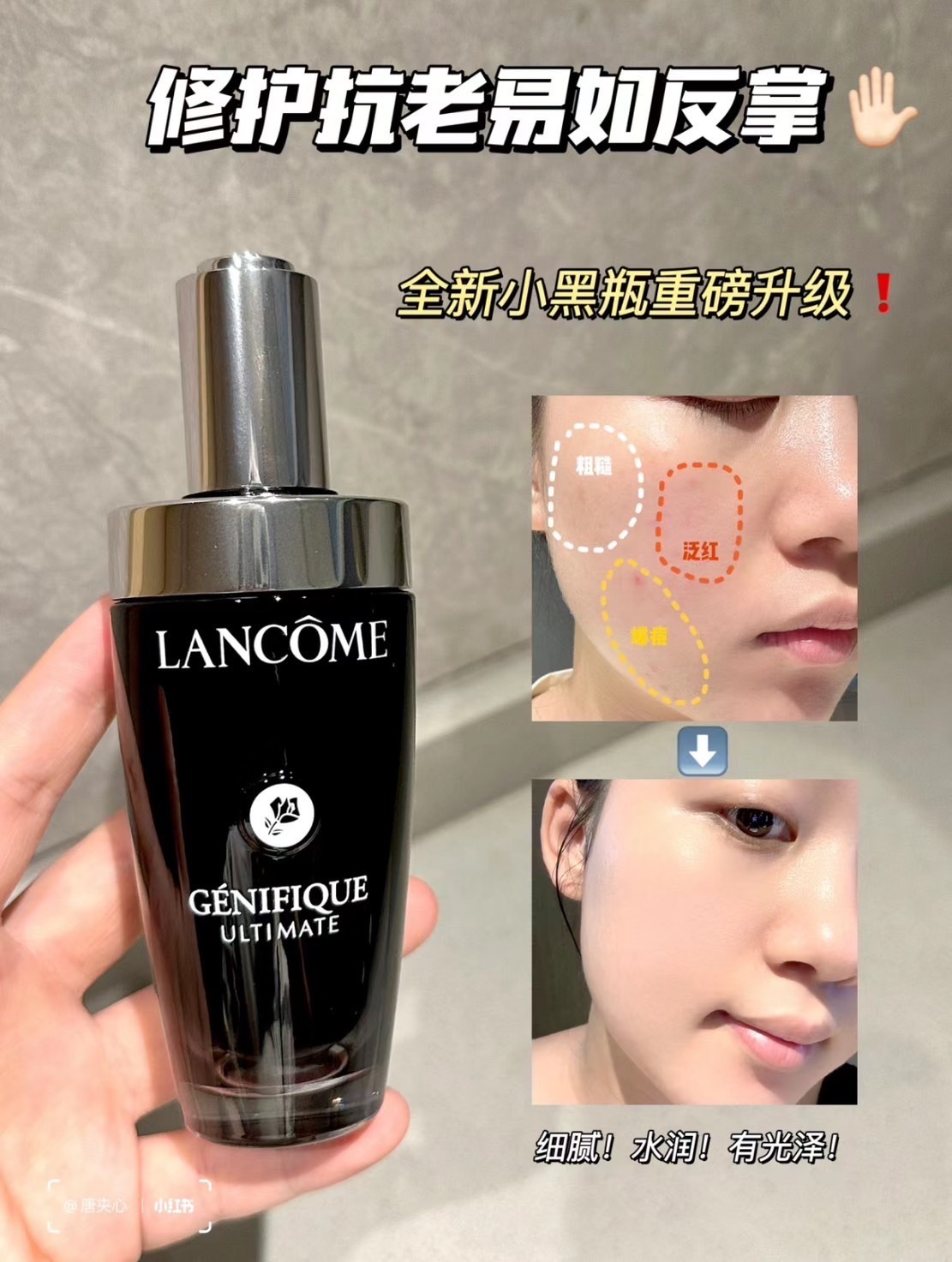 📦預購 Lancome蘭蔻-超極限肌因賦活露 小黑瓶PRO 115ml
