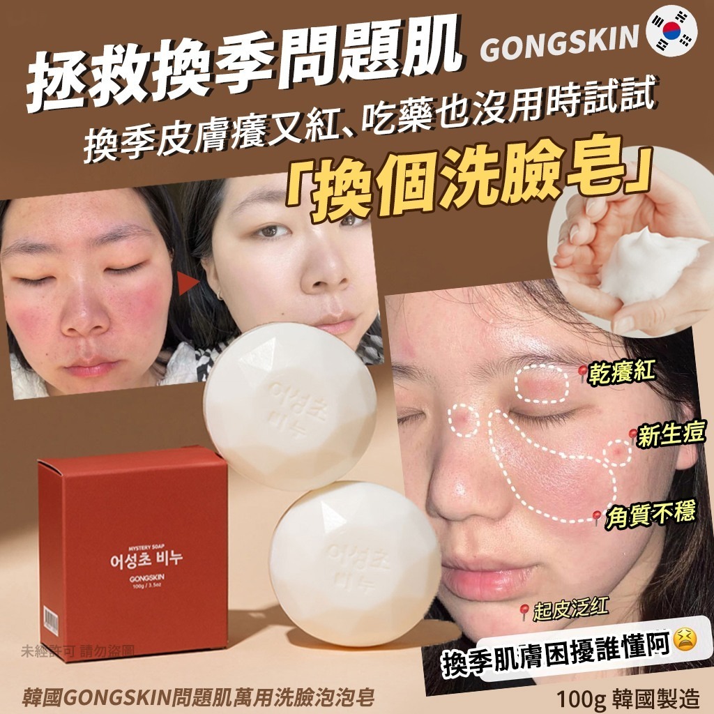 韓國GONGSKIN問題肌萬用洗臉泡泡皂(1套4個）