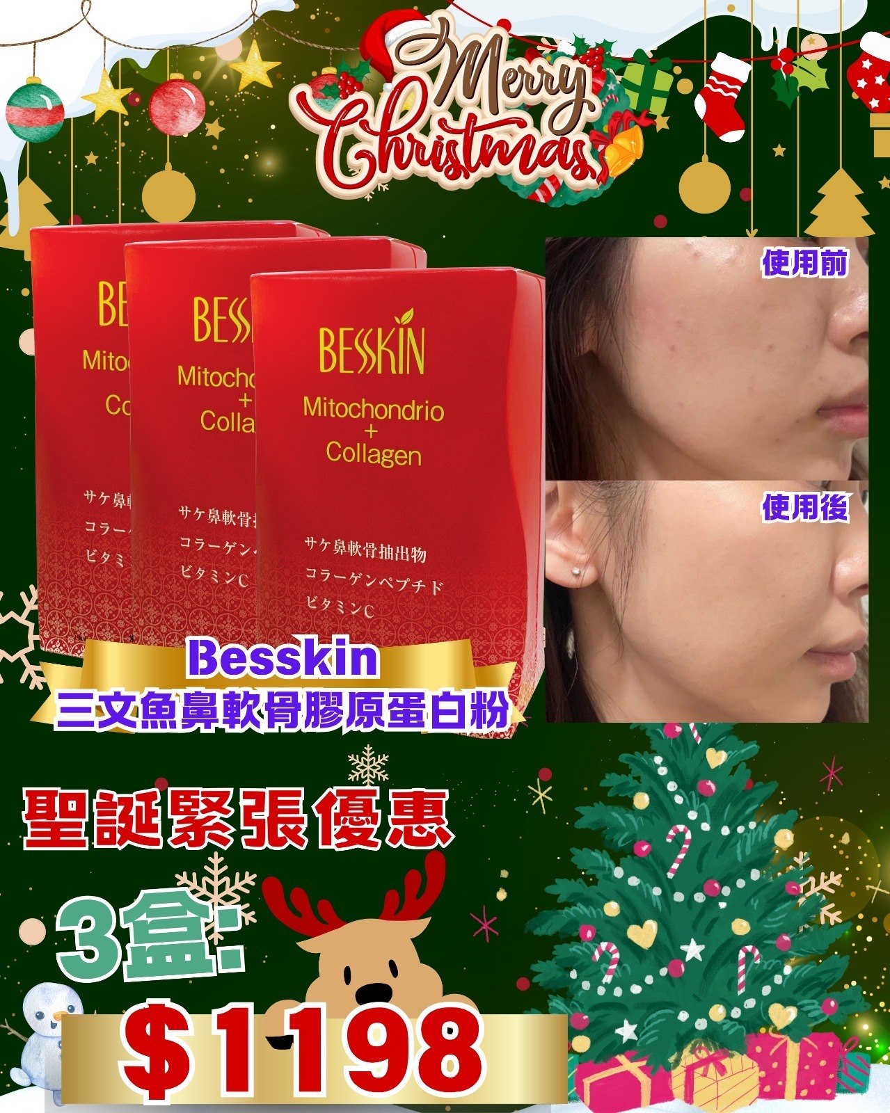 (1445)BESSKIN三⽂⿂⿐軟⾻膠原蛋⽩粉