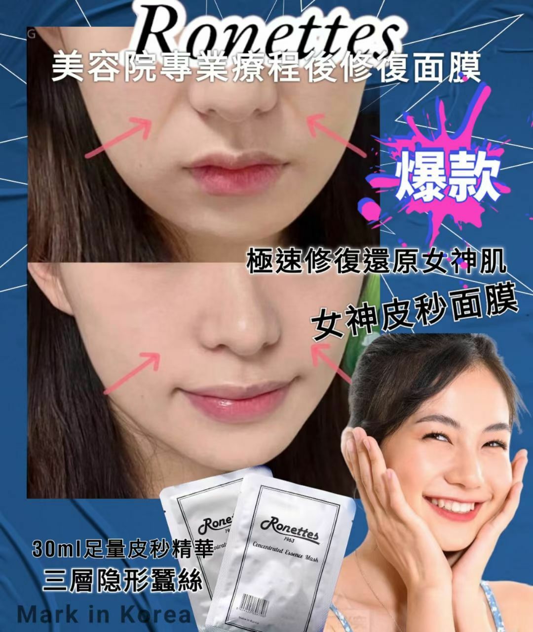 Ronettes 時光逆轉皮秒面膜 1套10片