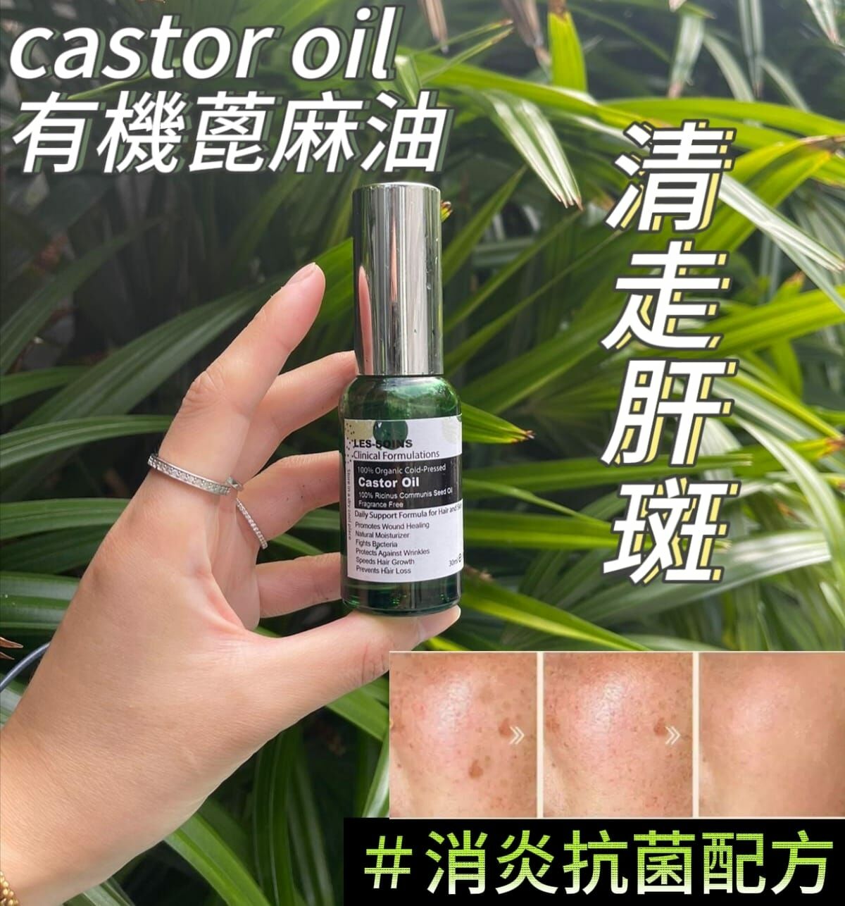 （打散肝斑）LES SOINS 100% 有機蓖麻油 30ml Y46（減少臉部和手部的肝斑、促進頭髮生長、強化指甲並舒緩乾燥皮膚及異位性過敏肌膚）
