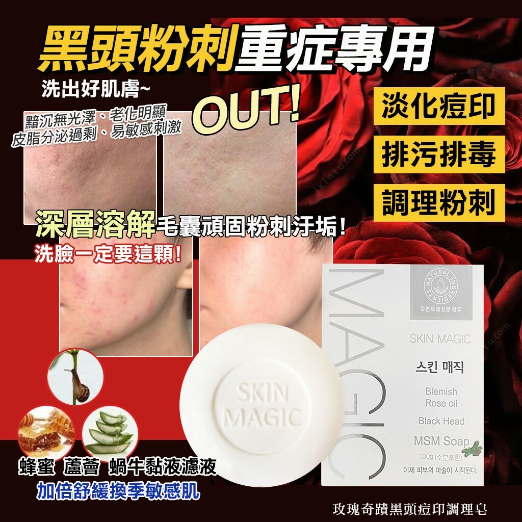 玫瑰奇蹟去黑頭痘印調理皂2.0升級版MSM 100g 1套2個