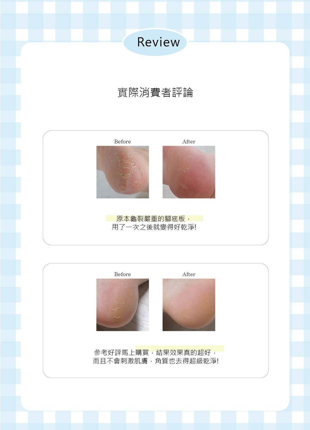 VADIVA WONDERFOOT腳底去角質板+去角質噴霧