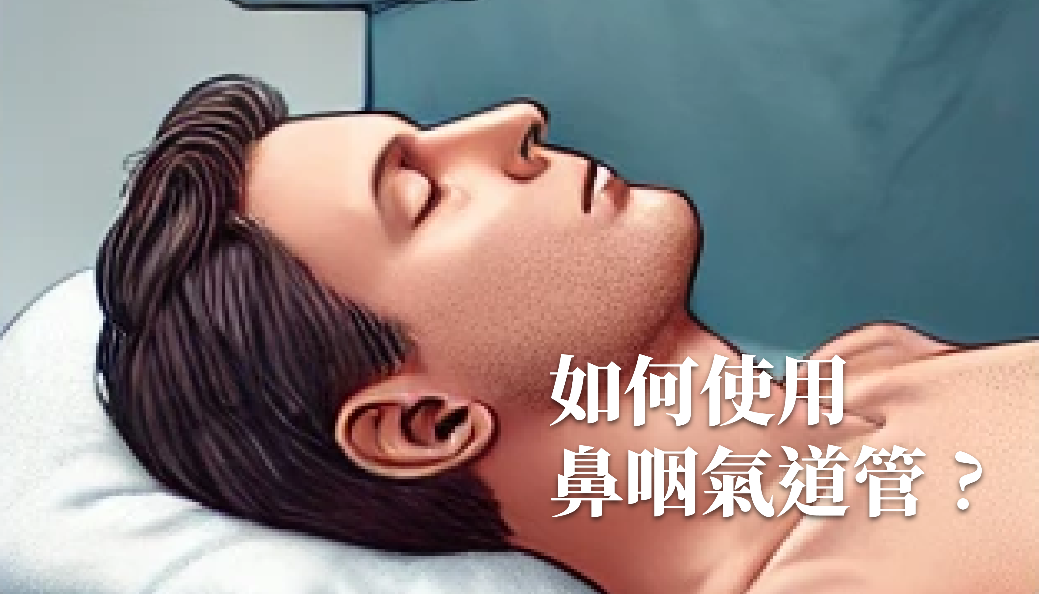 如何正確使用鼻咽氣道管 NPA？TCCC 戰傷知識｜傲骨戰術裝備屋正確使用鼻咽通氣道 (NPA) 的實用指南  鼻咽通氣道（Nasopharyngeal Airway, NPA）是一種在急救醫療中至關重要的裝置，用於維持有可能發生氣道阻塞患者的氣道暢通。在戰術及院前急救中，正確使用 NPA 可以拯救生命。以下是正確、安全使用 NPA 的操作指南。