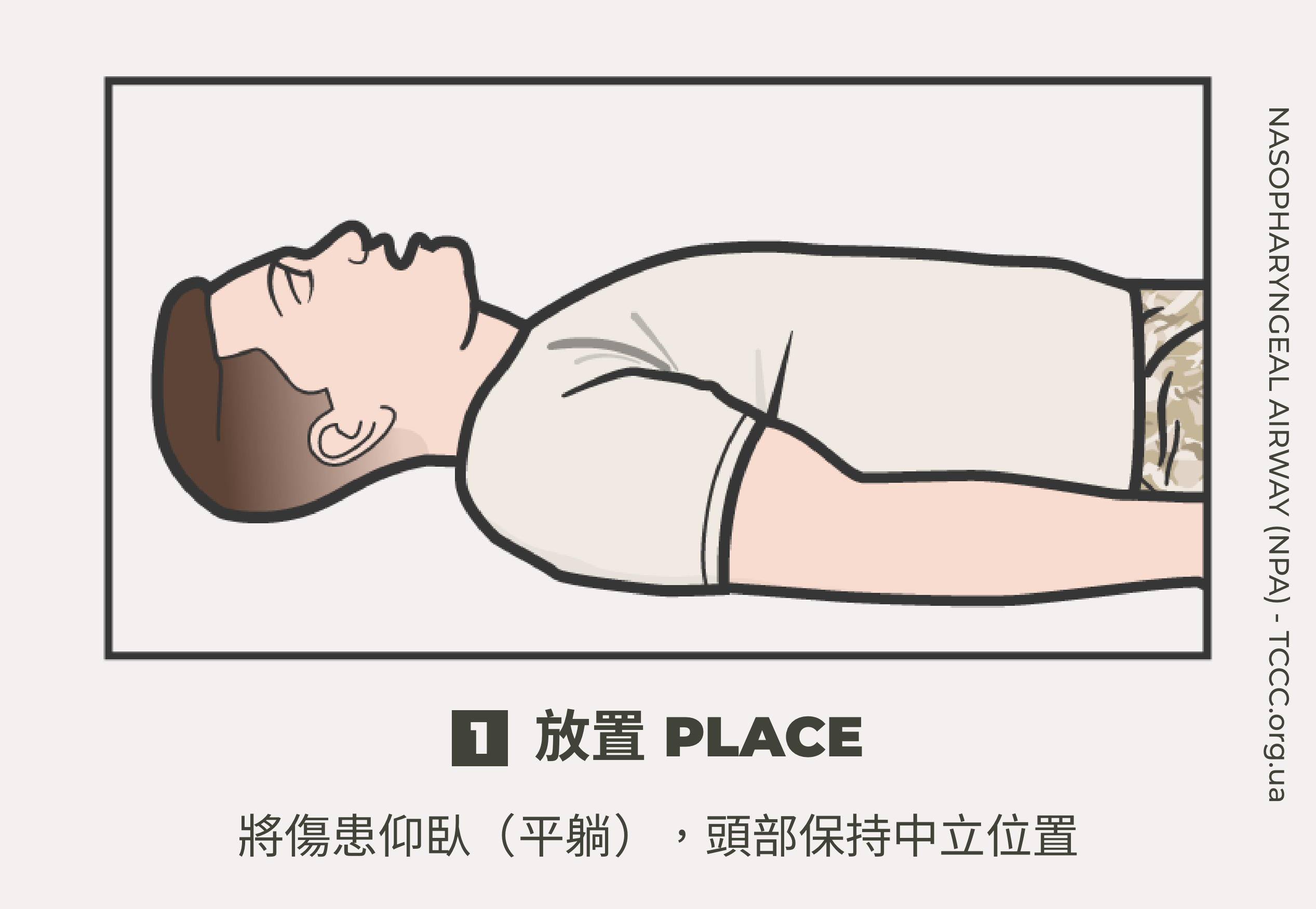 如何正確使用鼻咽氣道管 NPA？TCCC 戰傷知識｜傲骨戰術裝備屋01 放置  將傷患仰臥（平躺），頭部保持中立位置。