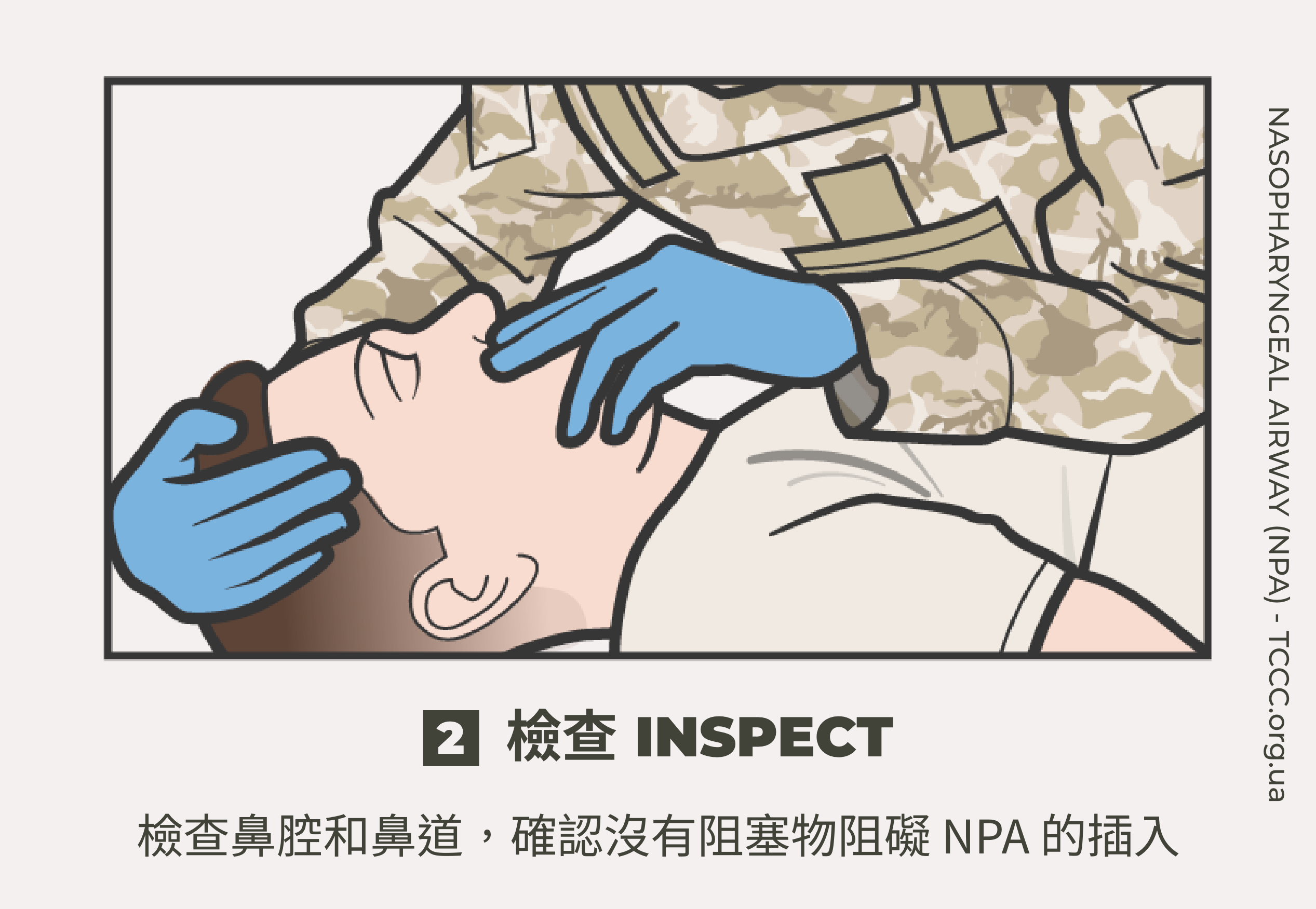 如何正確使用鼻咽氣道管 NPA？TCCC 戰傷知識｜傲骨戰術裝備屋02 檢查  檢查鼻腔和鼻道，確認沒有阻塞物阻礙 NPA 的插入。