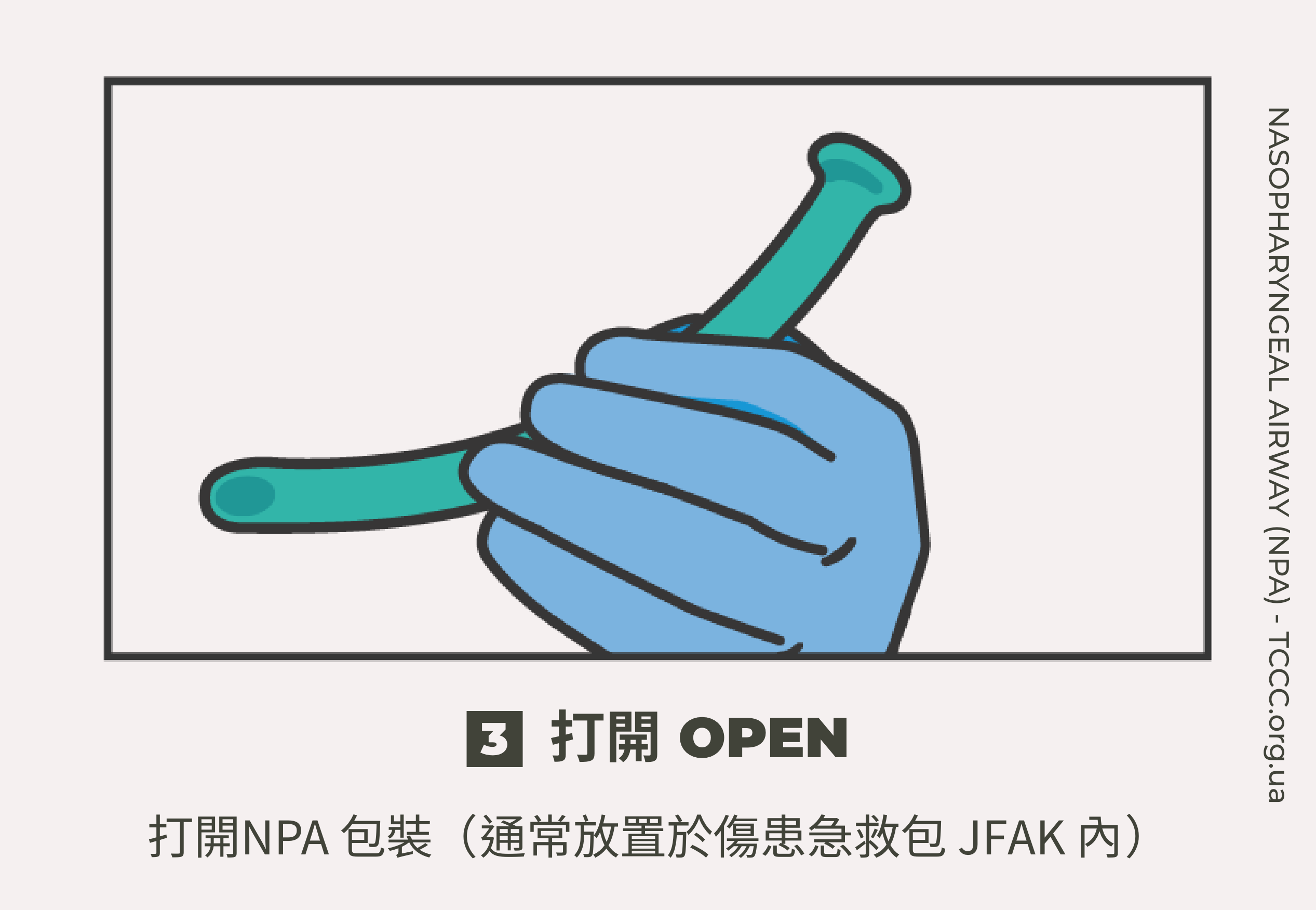 如何正確使用鼻咽氣道管 NPA？TCCC 戰傷知識｜傲骨戰術裝備屋03 打開  打開NPA 包裝（通常放置於傷患急救包 JFAK 內）。  注意：標準的 NPA（32 Fr）尺寸適合大多數急救包，並適合一般體型的軍人。
