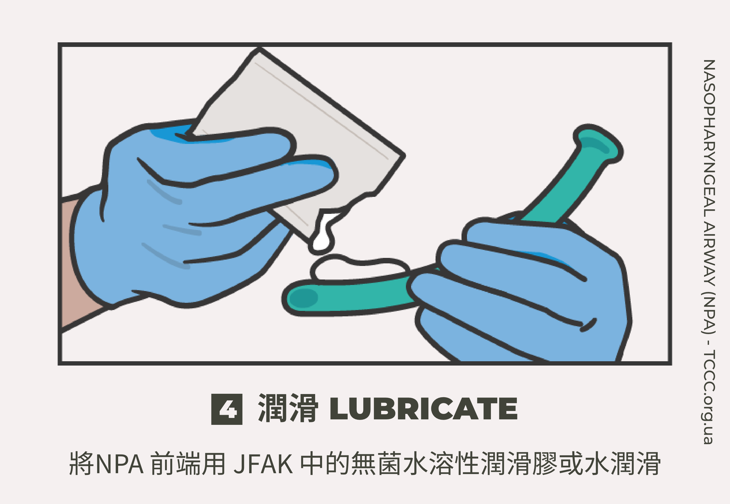 如何正確使用鼻咽氣道管 NPA？TCCC 戰傷知識｜傲骨戰術裝備屋04 潤滑  將NPA 前端用 JFAK 中的無菌水溶性潤滑膠或水潤滑。  第 4 步注意：切勿使用血液或非水基潤滑劑；不過，可以使用患者的唾液。