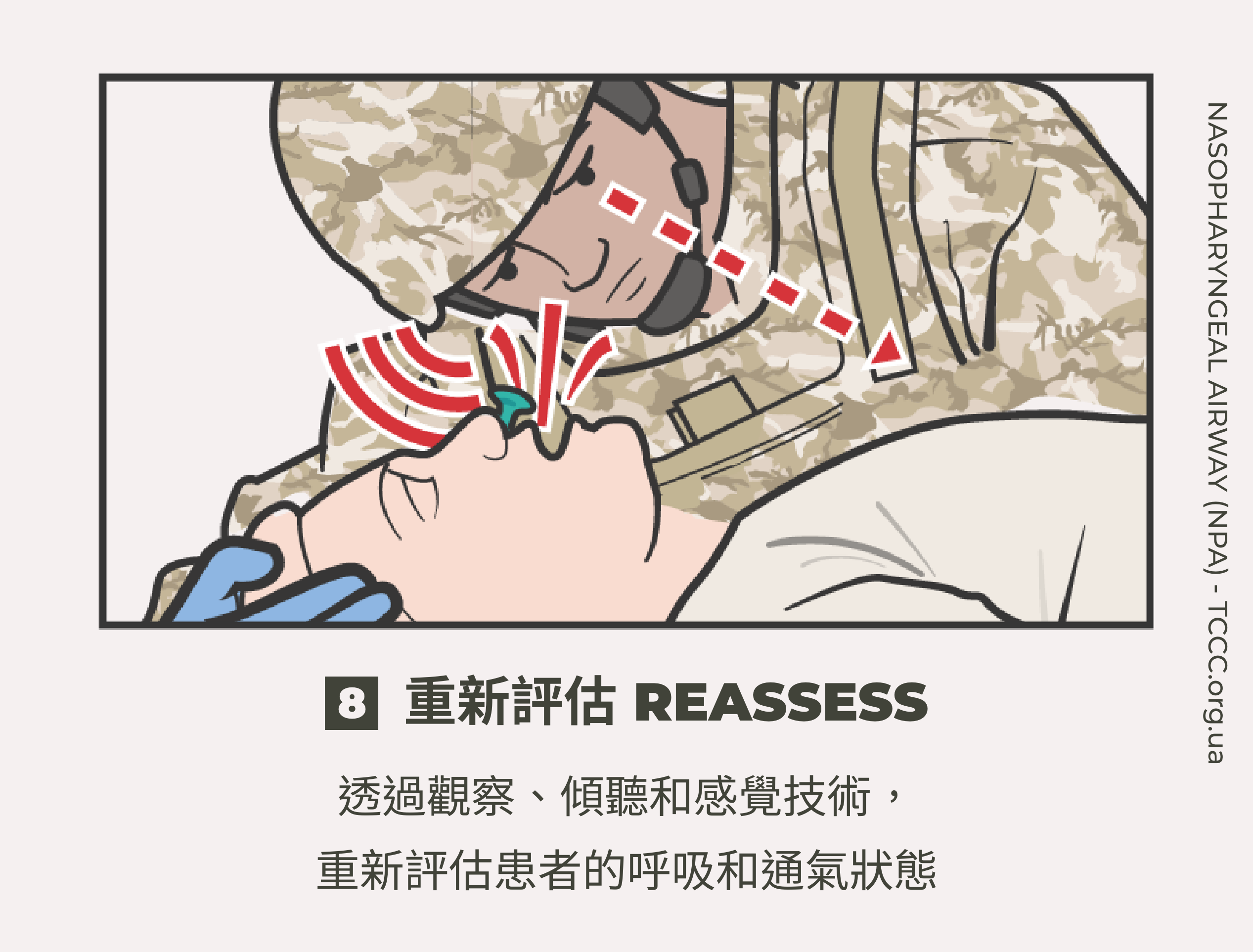 如何正確使用鼻咽氣道管 NPA？TCCC 戰傷知識｜傲骨戰術裝備屋08 重新評估  透過觀察、傾聽和感覺技術，重新評估患者的呼吸和通氣狀態。