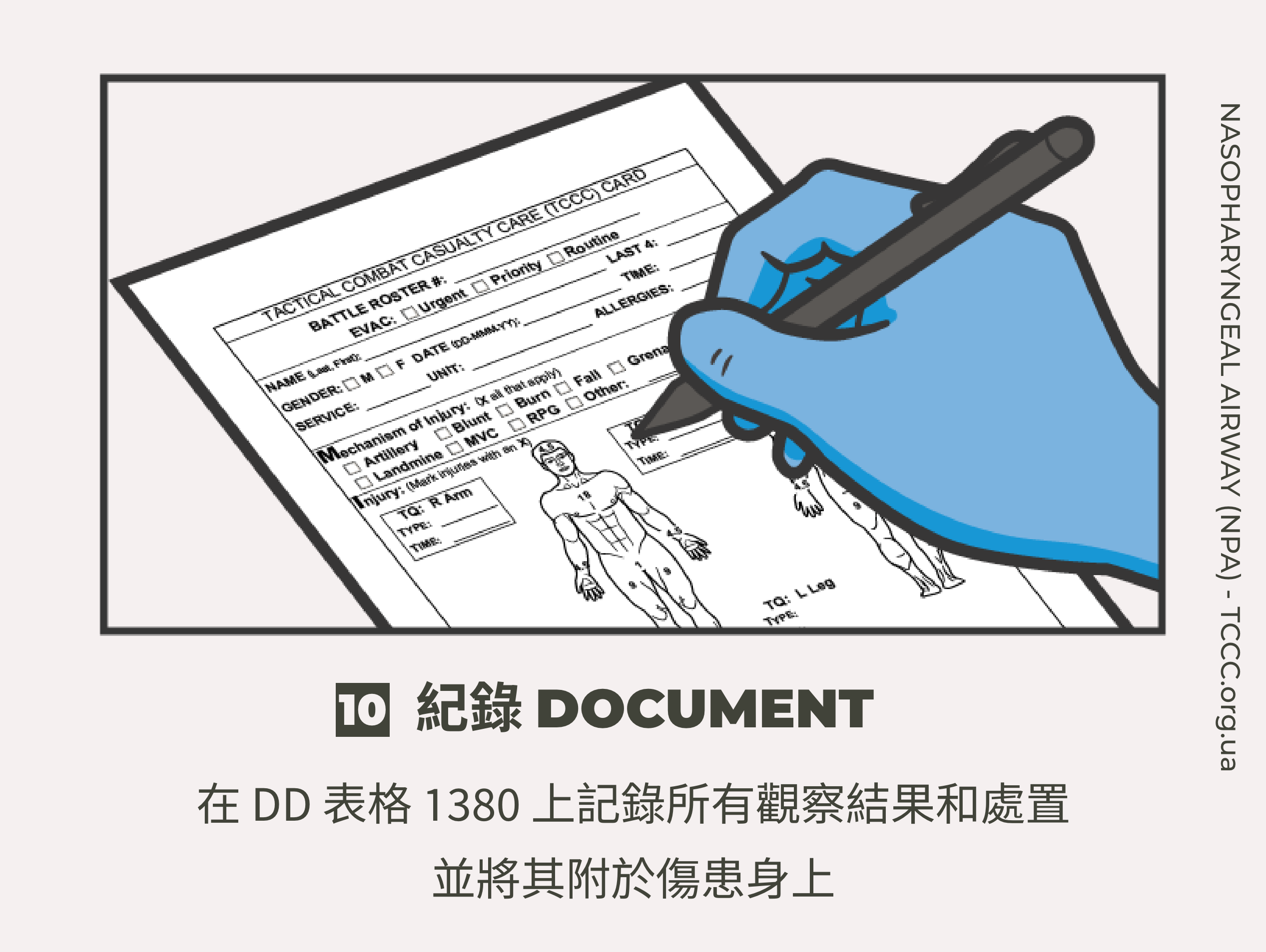 如何正確使用鼻咽氣道管 NPA？TCCC 戰傷知識｜傲骨戰術裝備屋10 記錄  在 DD 表格 1380 上記錄所有觀察結果和處置，並將其附於傷患身上。