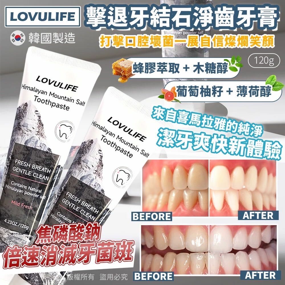 韓國製造 LOVULIFE齒垢分解 去牙結石淨齒牙膏（1套3支）