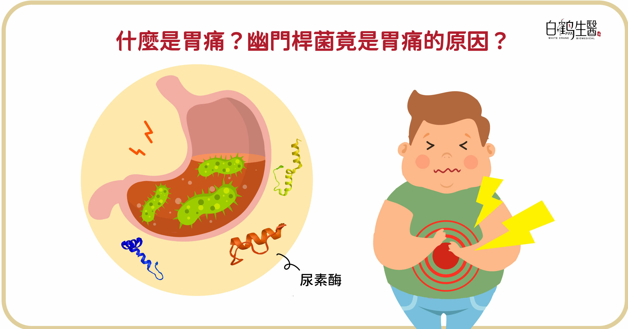 引發胃痛的原因眾多，但不能忽略幽門桿菌對人體的危害。幽門桿菌附著於胃黏膜層中，會分泌「尿素酶」，導致胃發炎，增加罹患消化道疾病的風險