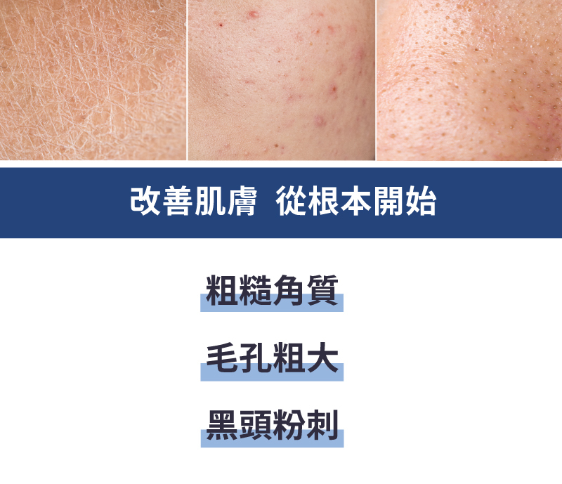 【MUNICHI】親膚磁珠潔面儀 MR.FACE-改善肌膚