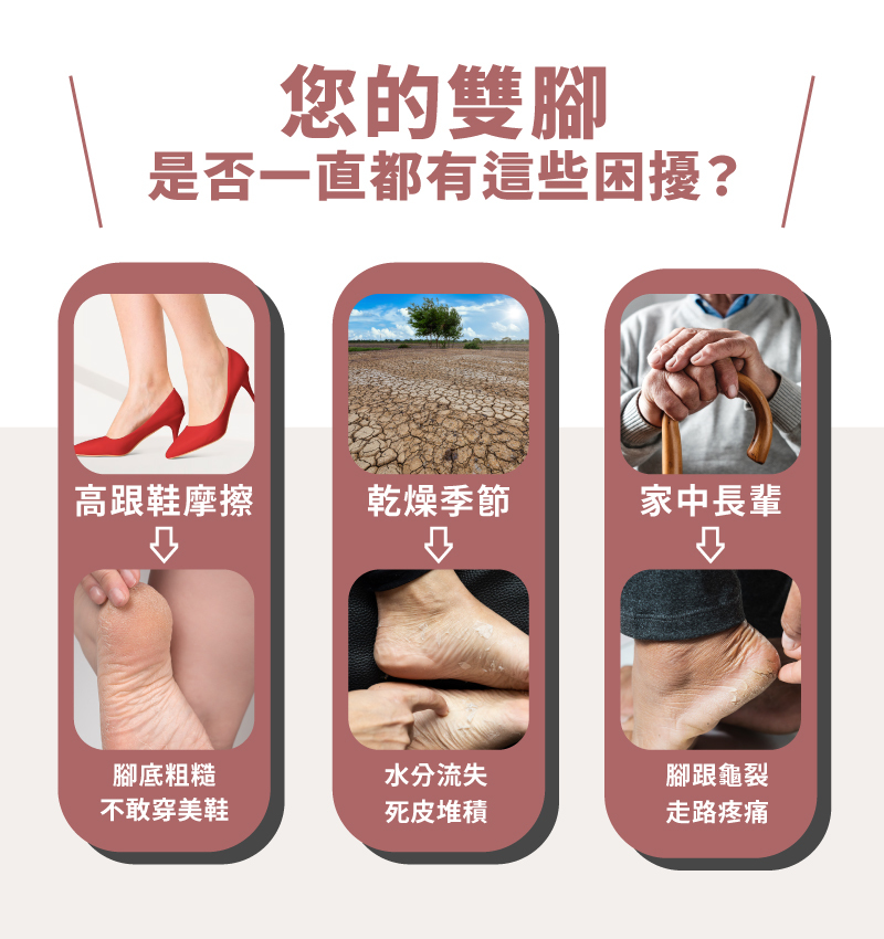 【MUNICHI】電動磨腳皮機(自動去腳皮機) MR.FEET-腳皮困擾