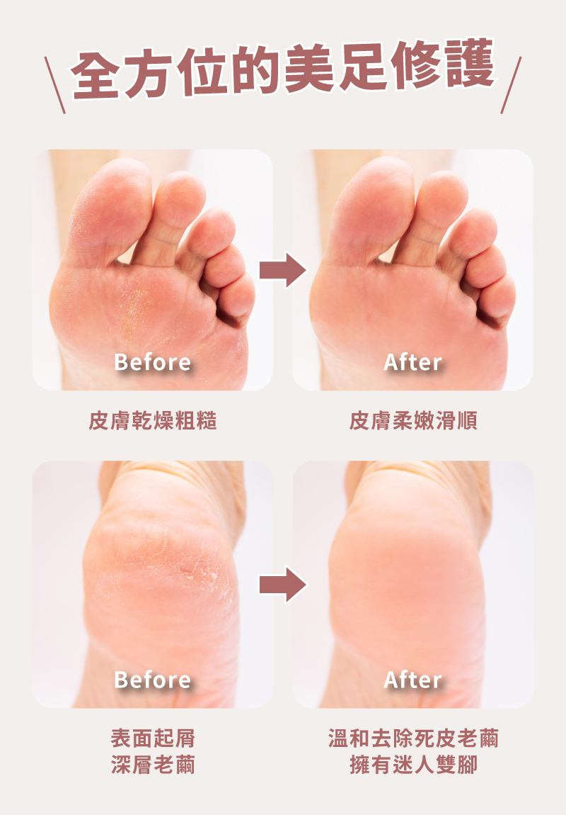【MUNICHI】電動磨腳皮機(自動去腳皮機) MR.FEET-使用前後