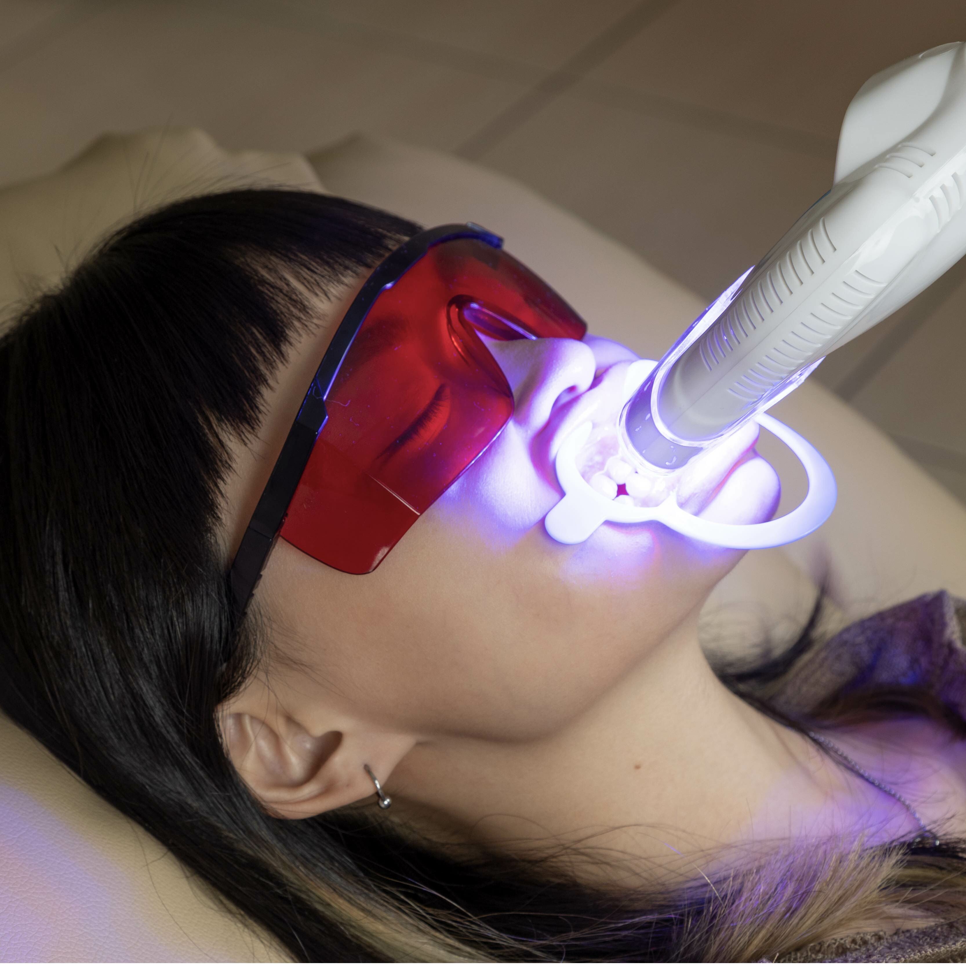 《台北》迅速美牙密技!鑽石紅藍光瞬效淨齒美牙課程,799元