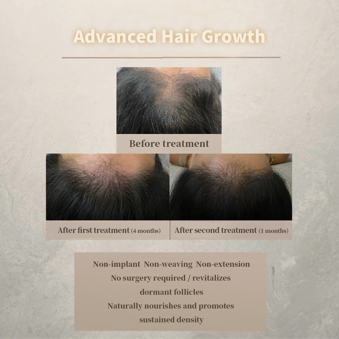 Advanced hair growth treatment results provided by 98 Hair