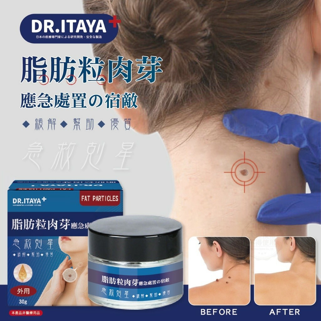 [M2534] [現貨] (K7) DR.ITAYA 袪脂肪粒肉芽急救剋星 30g