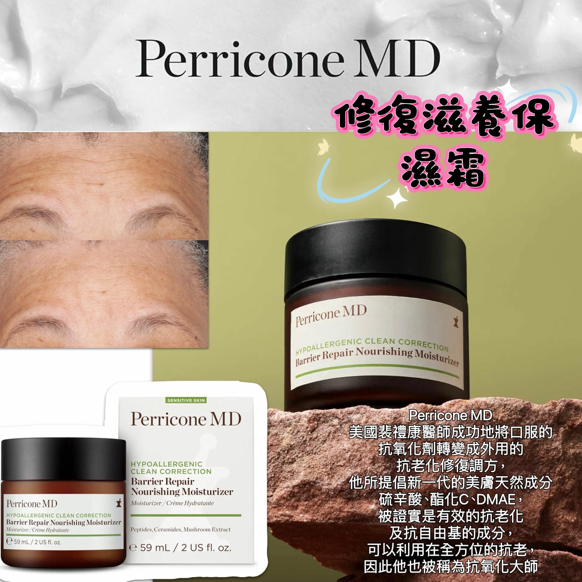 【預購】Perricone MD Hypoallergenic G123032 修復滋養保濕霜