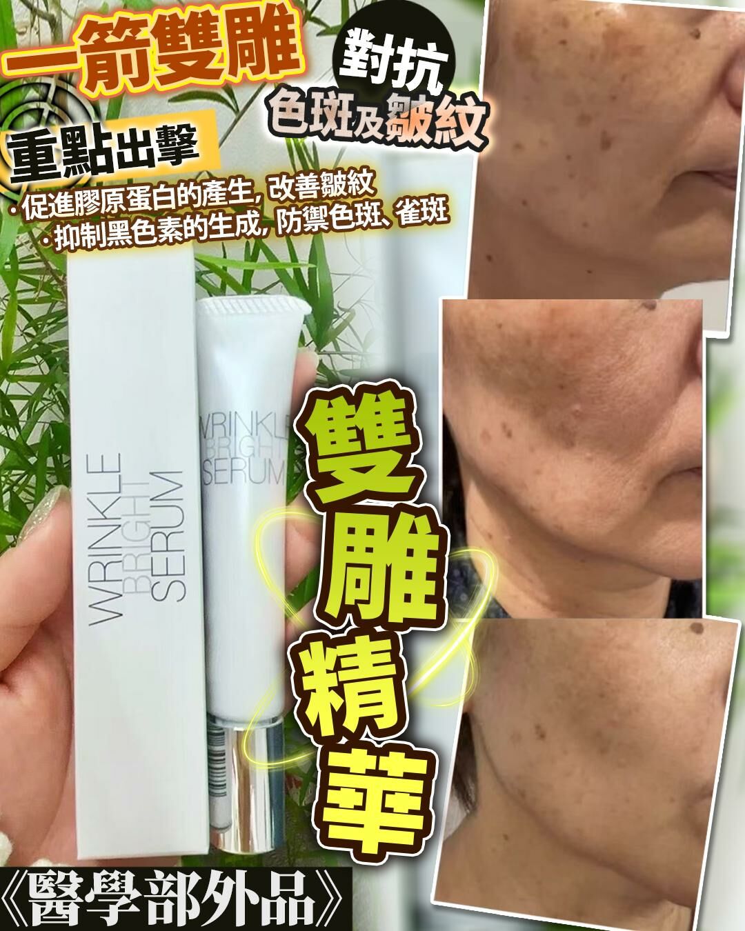 💥日本 斑紋救星 20g