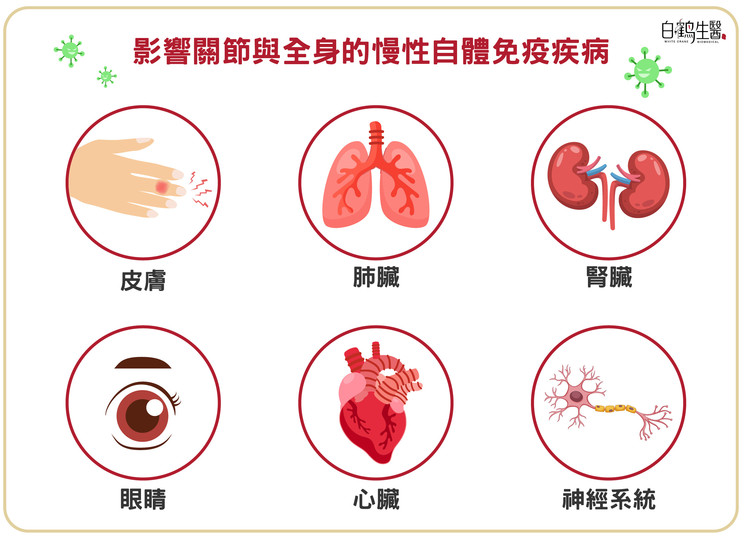 類風溼性關節炎是一種自體免疫性疾病，可能會進而影響皮膚、眼睛、肺臟、心臟、腎臟與神經系統