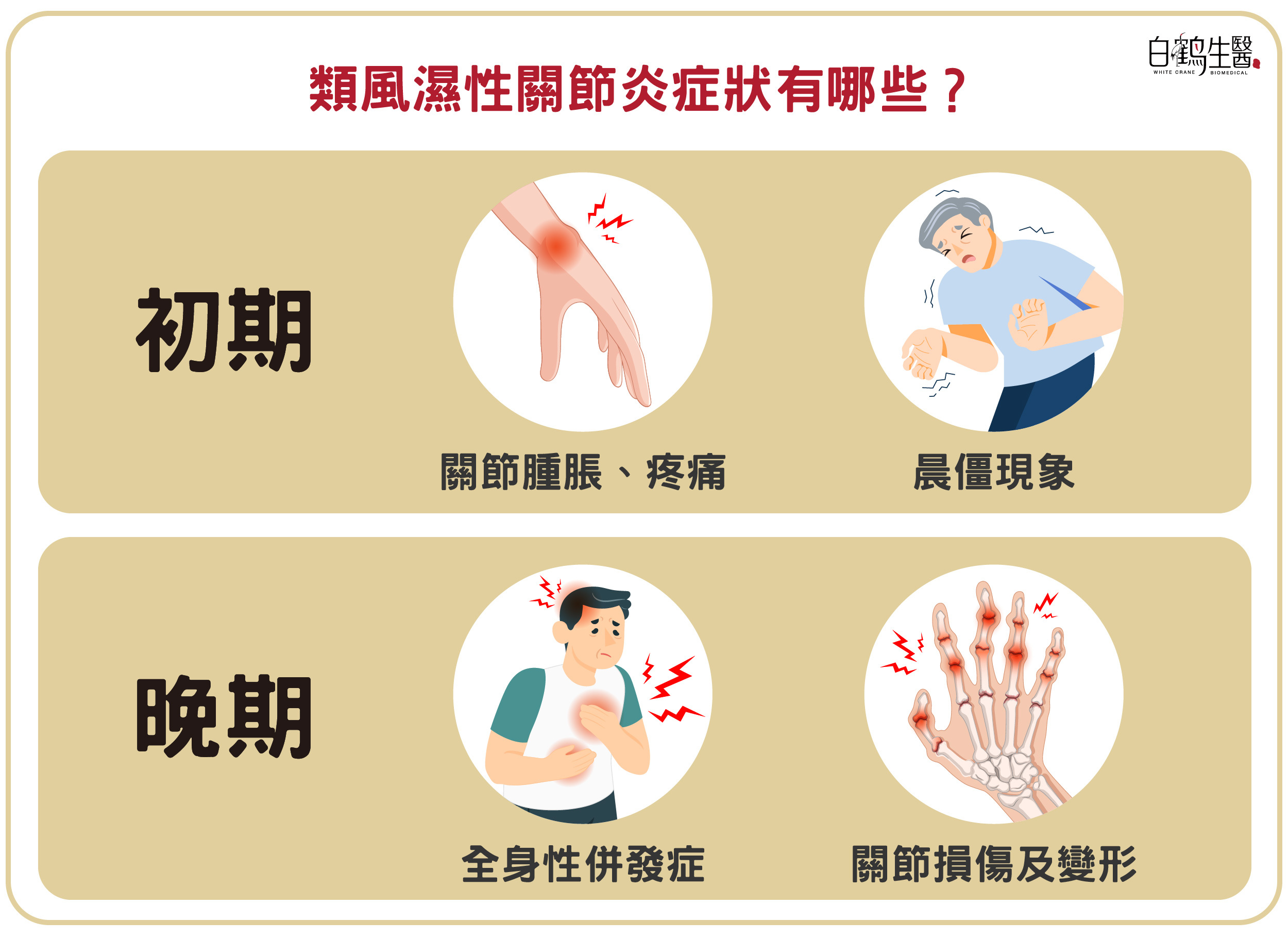 類風溼性關節炎初期多以輕微症狀為主，包含疲倦、發燒、淋巴腺腫大，晚期隨著病其惡化可能導致嚴重的關節損傷及全身併發症