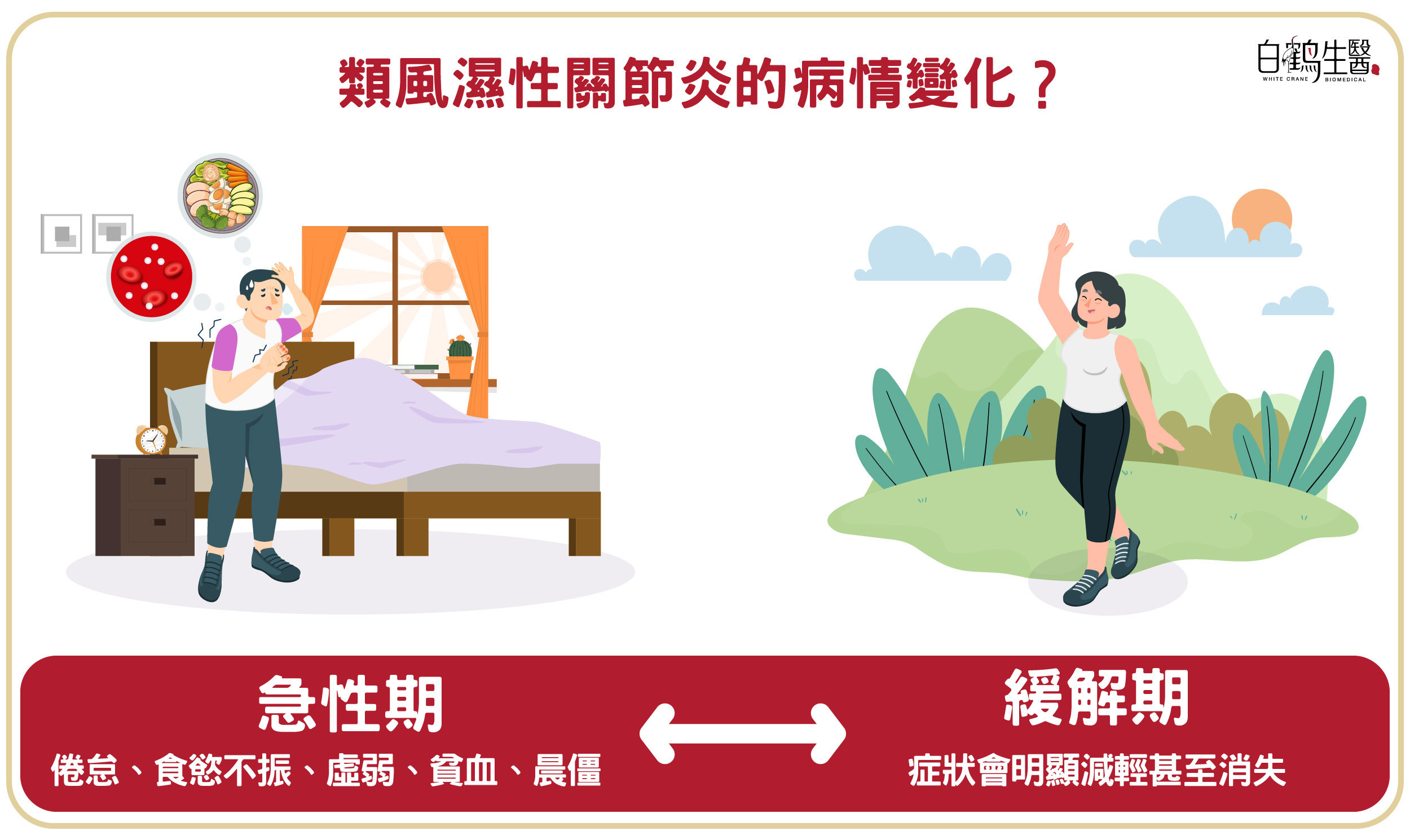 類風溼性關節炎的病程常以急性期與緩解期交替出現，急性期常見症狀為倦怠、食慾不振、虛弱、貧血、晨僵