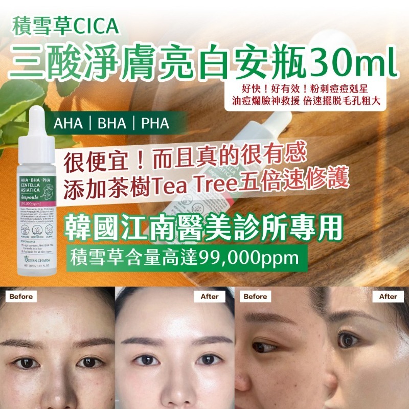 韓國製造 積雪草CICA 三酸淨膚亮白安瓶