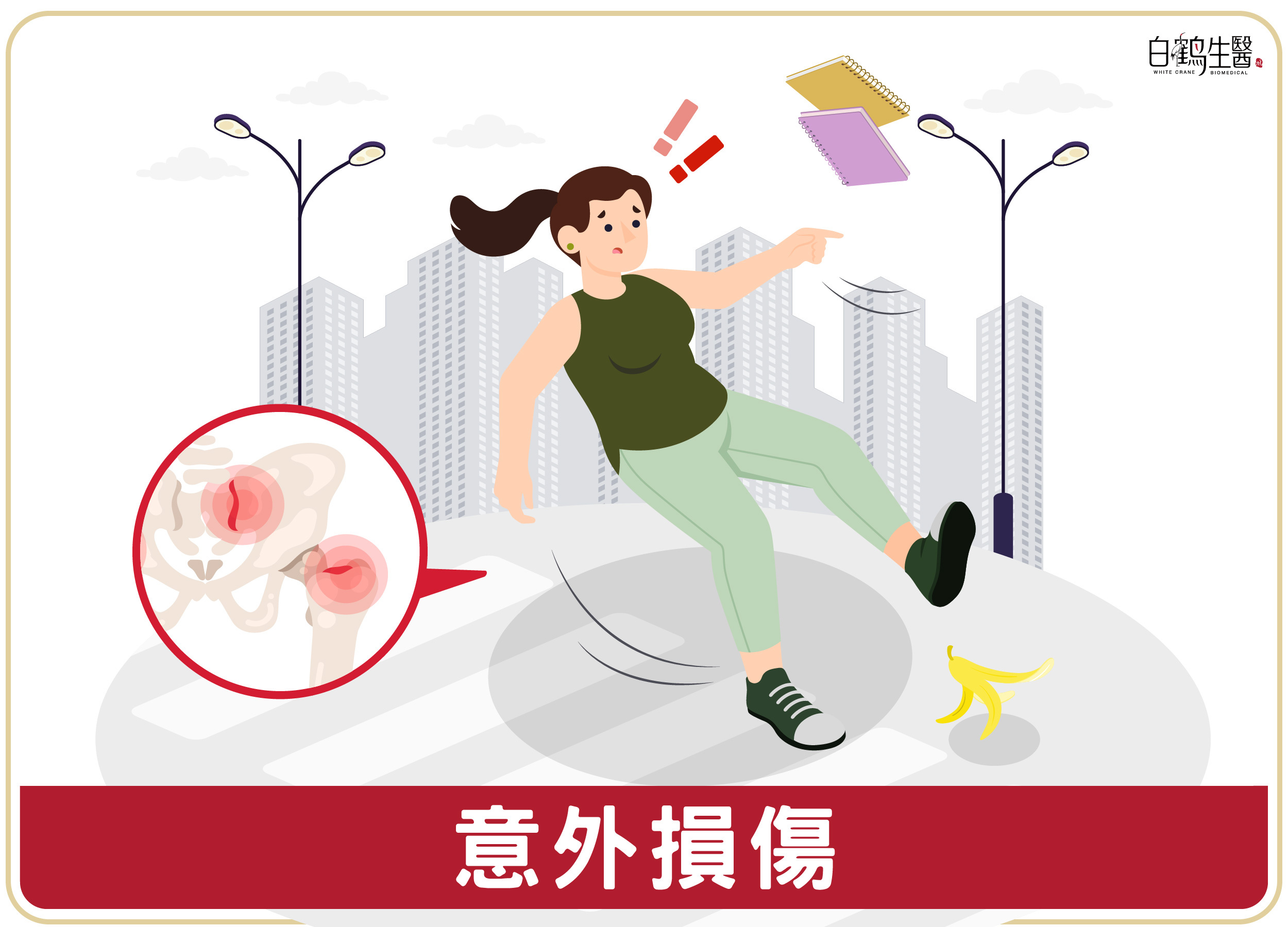 關節痛可能是因為跌倒、撞擊或扭傷等意外損傷造成的。