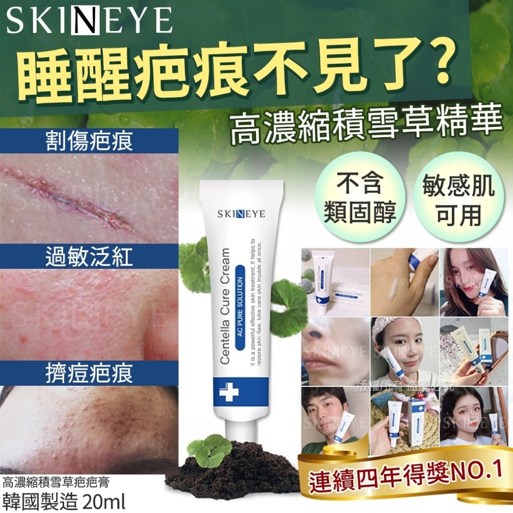 韓國SKINEYE高濃縮積雪草疤疤膏20ml