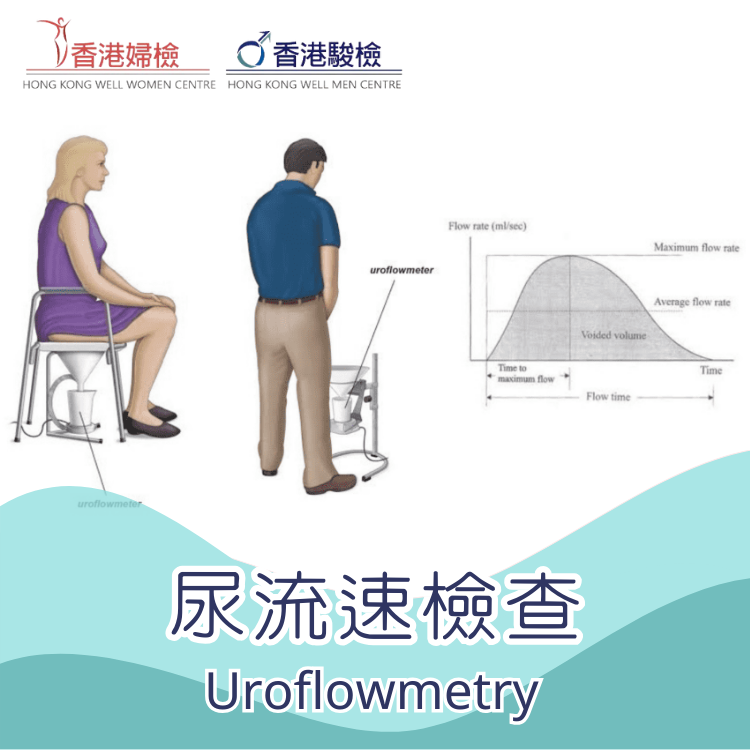 尿流速檢查