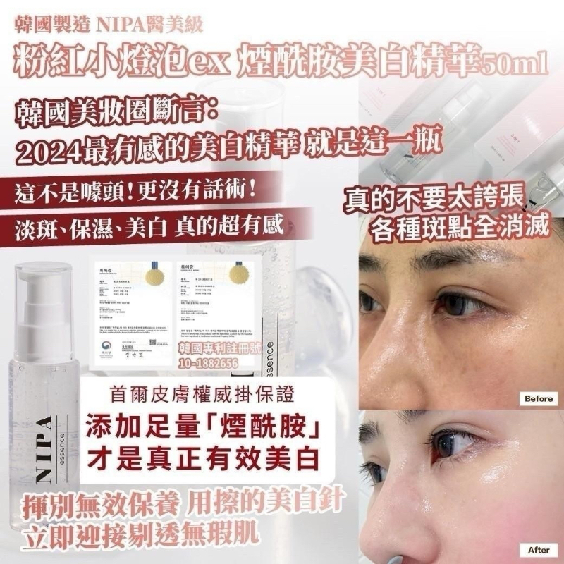 韓國製造 NIPA醫美級  粉紅小燈泡ex 煙酰胺美白精華