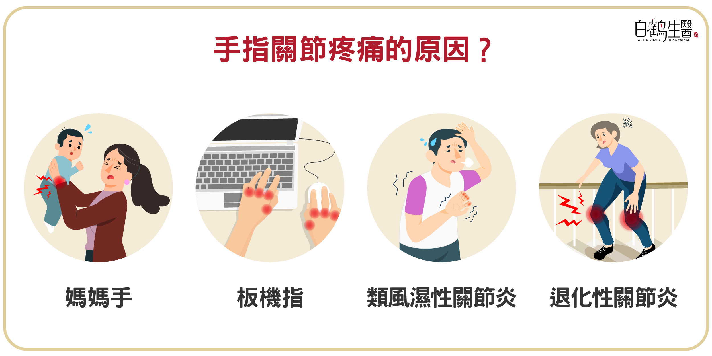 手指關節疼痛的原因包含：媽媽手、板機指、類風溼性關節炎、退化性關節炎