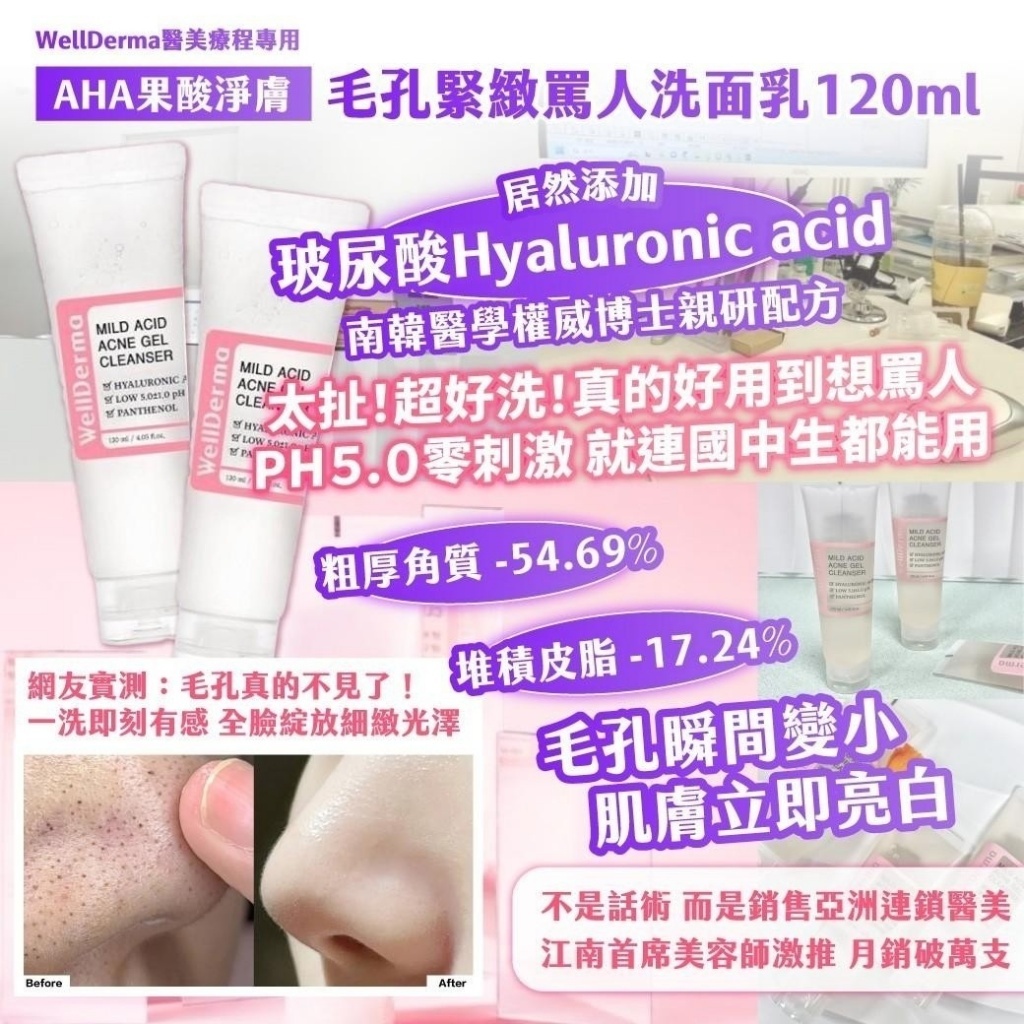 韓國製造WellDerma醫美療程專用｜ AHA果酸淨膚 毛孔緊緻罵人洗面乳