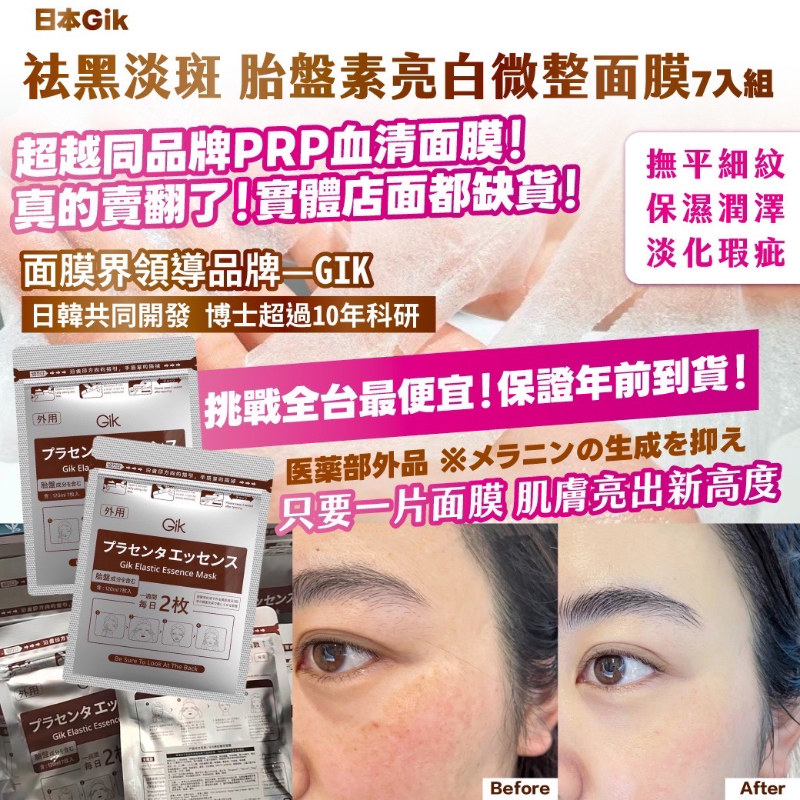 日本Gik祛黑淡斑 胎盤素亮白微整面膜