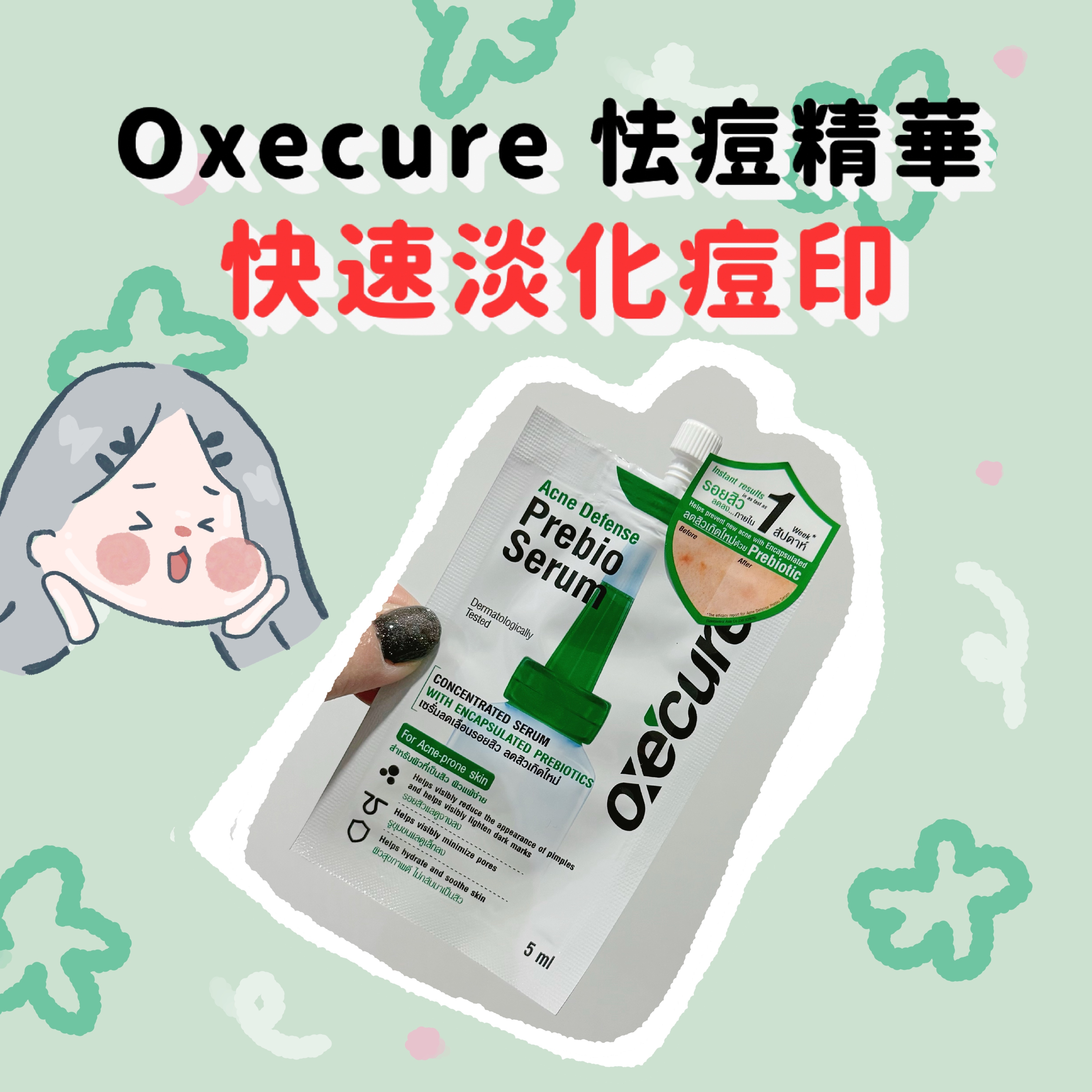 Oxecur PreBio serum怯痘精華液 5ml