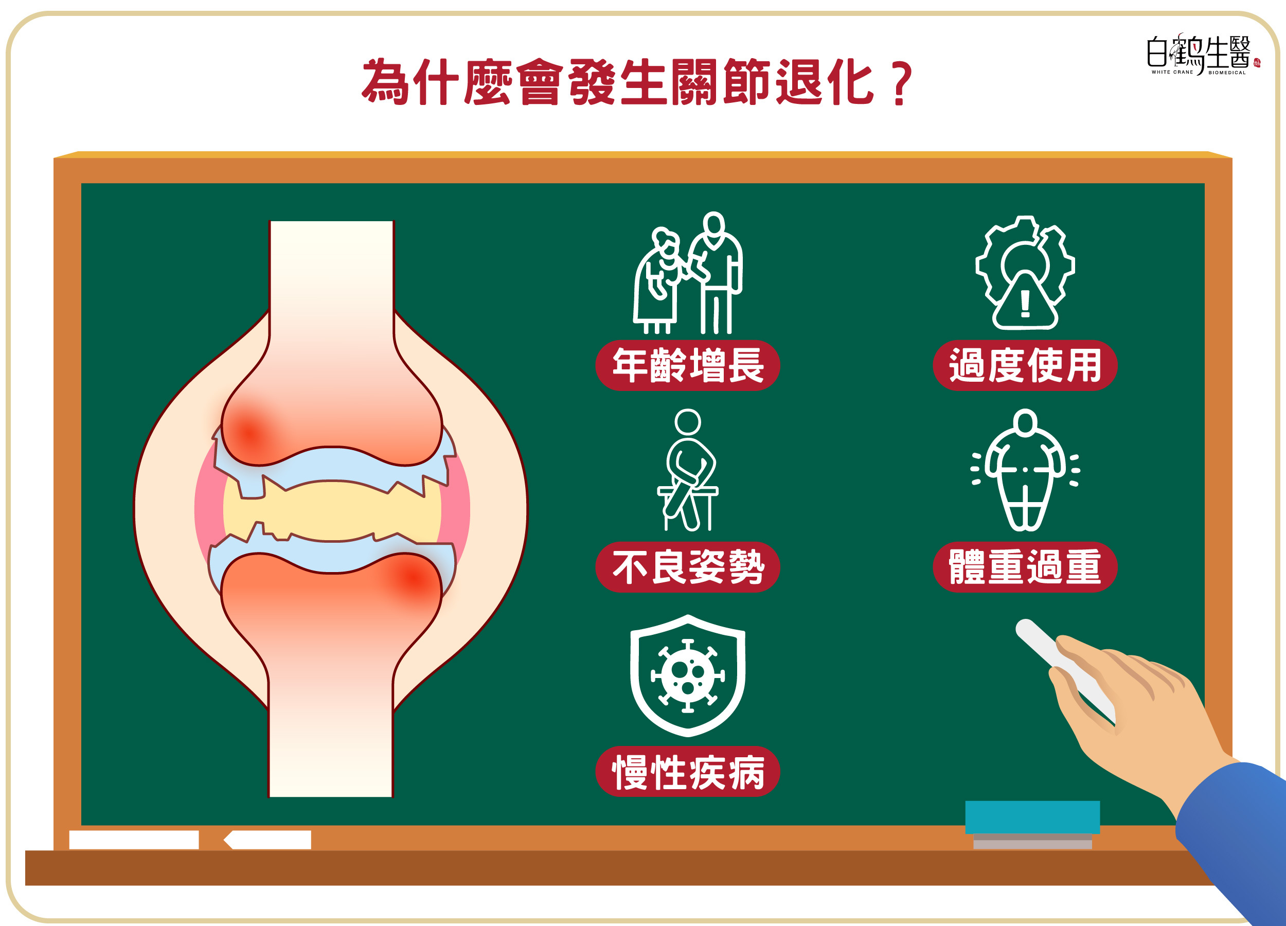 造成關節退化的原因包含年齡增長、過度使用、不良姿勢、體重過重以及慢性疾病