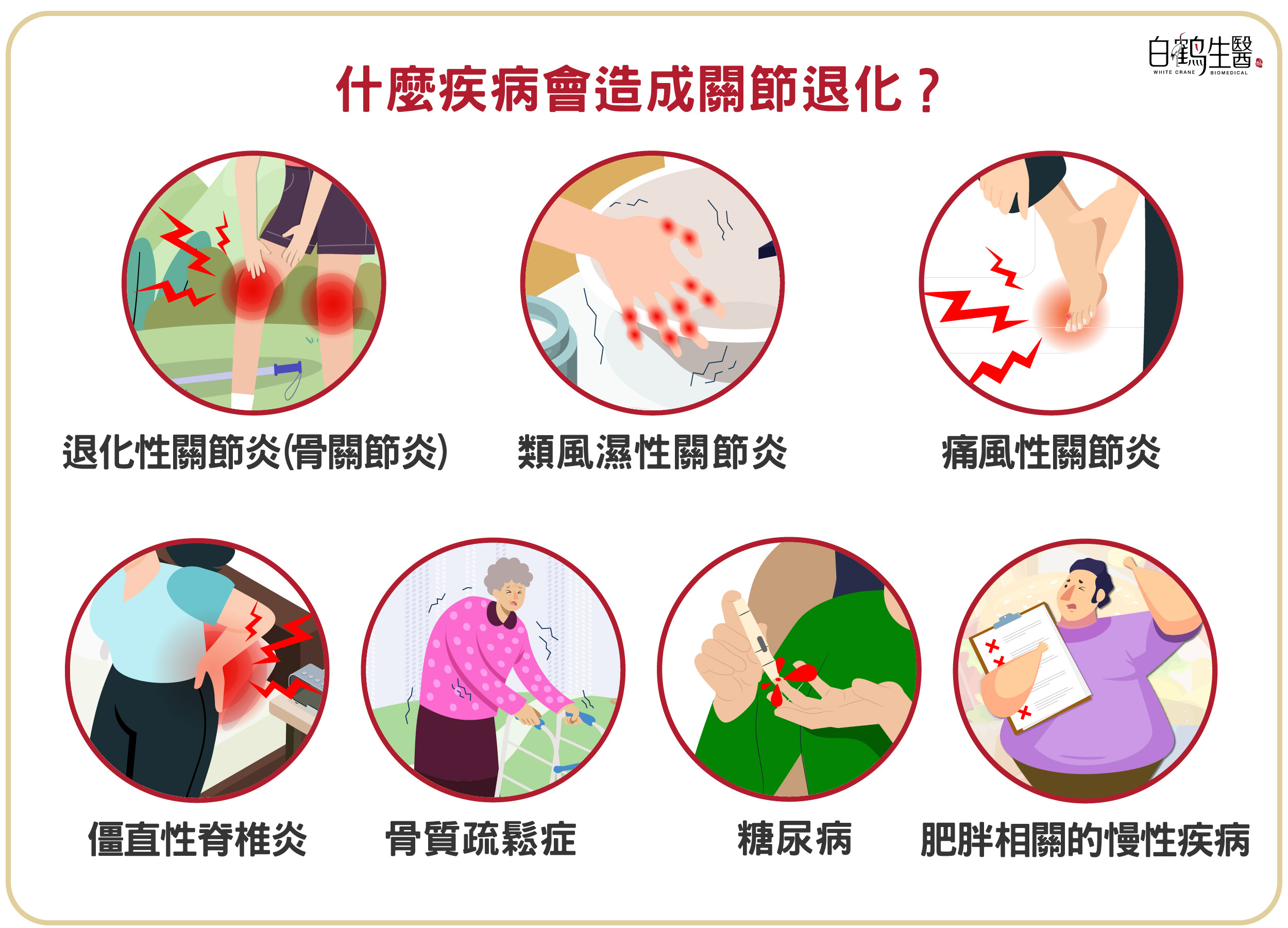 退化性關節炎、類風溼性關節炎、痛風、僵直性脊椎炎、骨質疏鬆、糖尿病、肥胖相關慢性疾病皆有可能造成關節退化